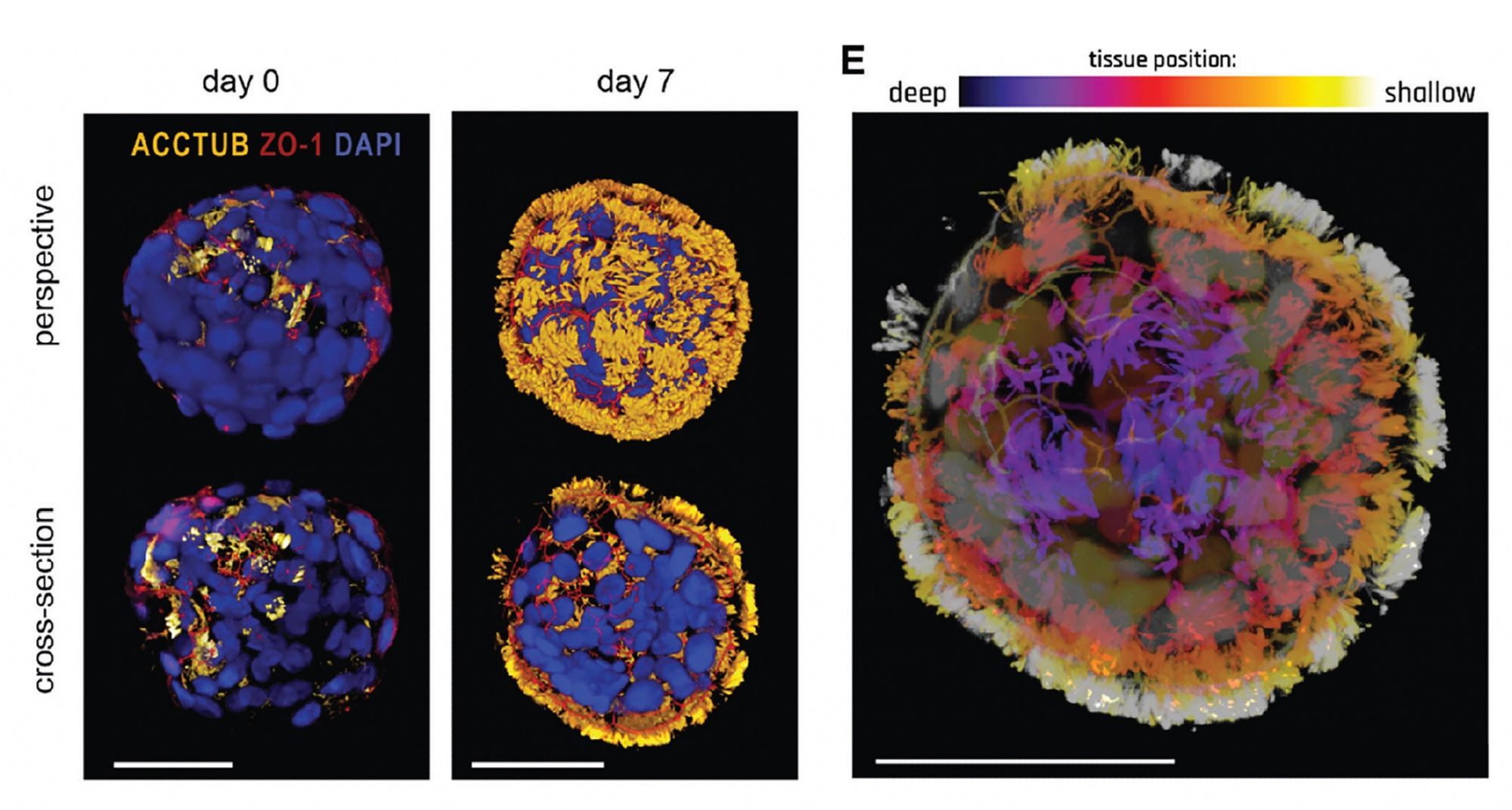 The development of a multi-cellular human biobot from lung (trachea) cells