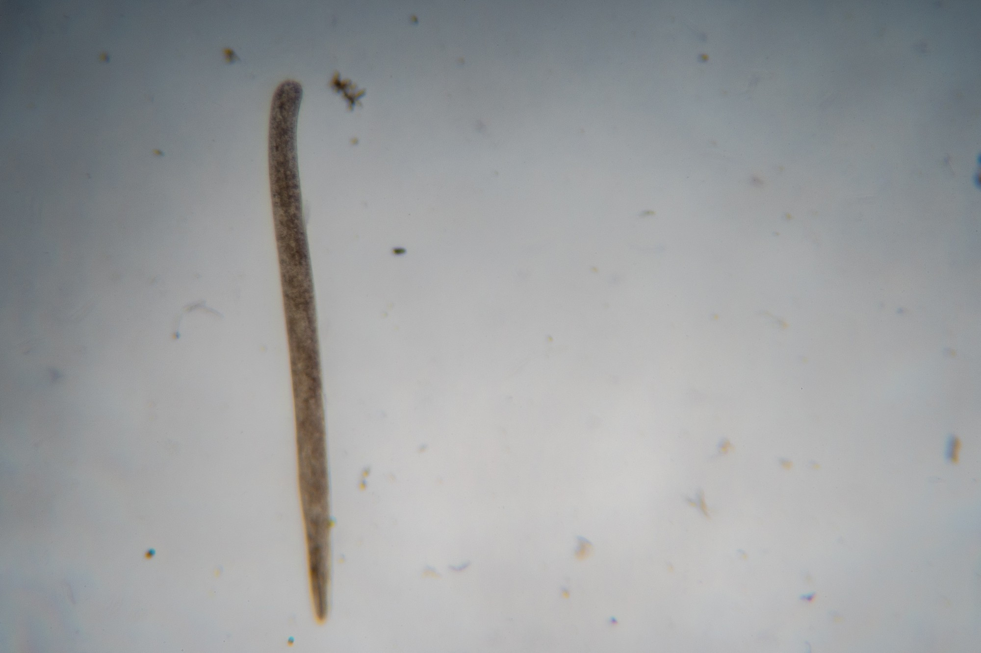 A long, thin Ciliate with a round front and a blunt end (Probably Spirostomum ambiguum).