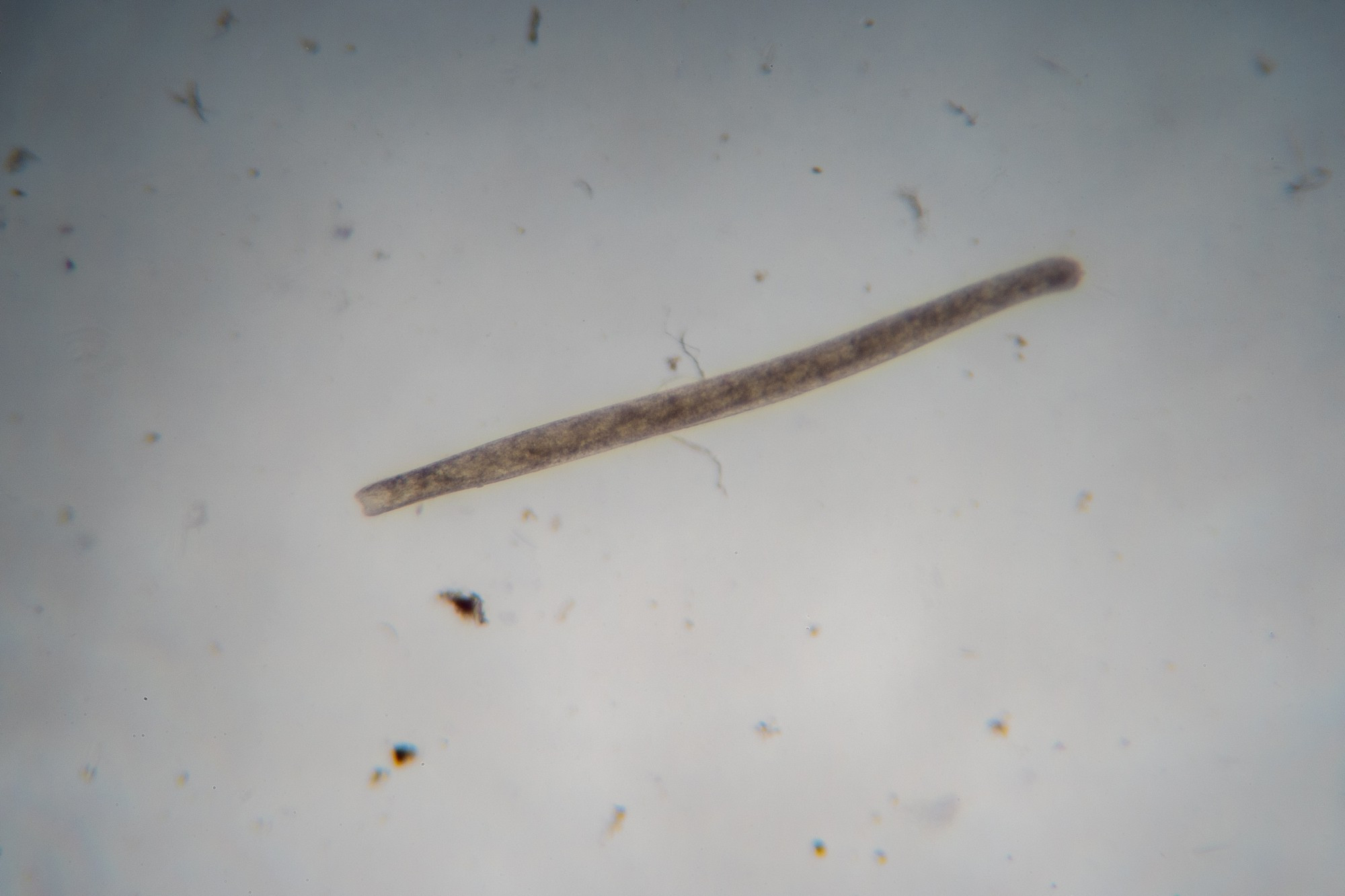 A long, thin Ciliate with a round front and a blunt end (Probably Spirostomum ambiguum).