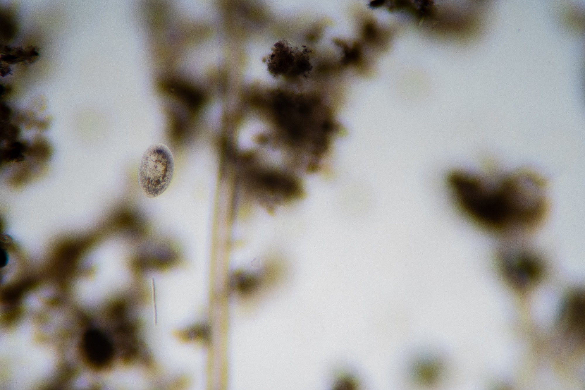 A mostly transparent oval shaped ciliate in focus above some out of focus brown debris. This is a microscope picture at roughly 100X.