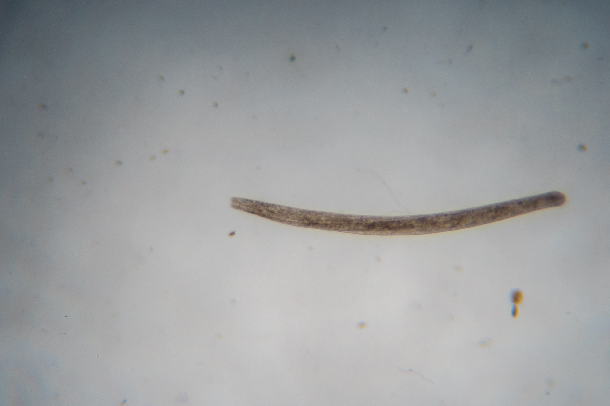 A long, thin Ciliate with a round front and a blunt end (Probably Spirostomum ambiguum).