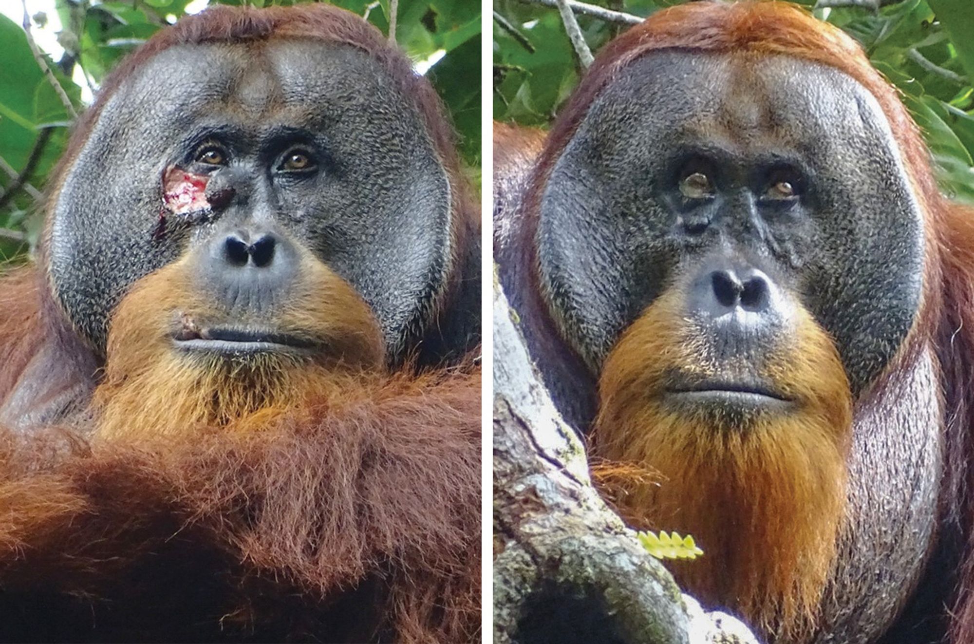 Rakus, a Sumatran orangutan, suffered a wound on his face (left) but fully healed (right) after treating himself with a medicinal plant. LEFT TO RIGHT: ARMAS; SAFRUDDIN