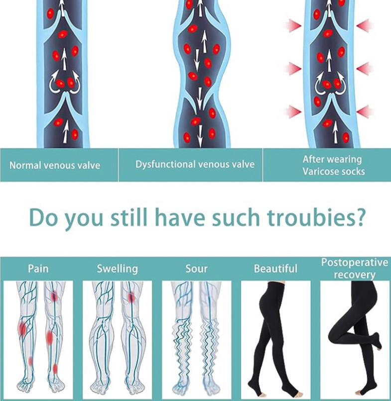 photo diagram for compression stockings. across the middle it reads "Do you still have such troubies?" clearly a typo or some kind of translation error