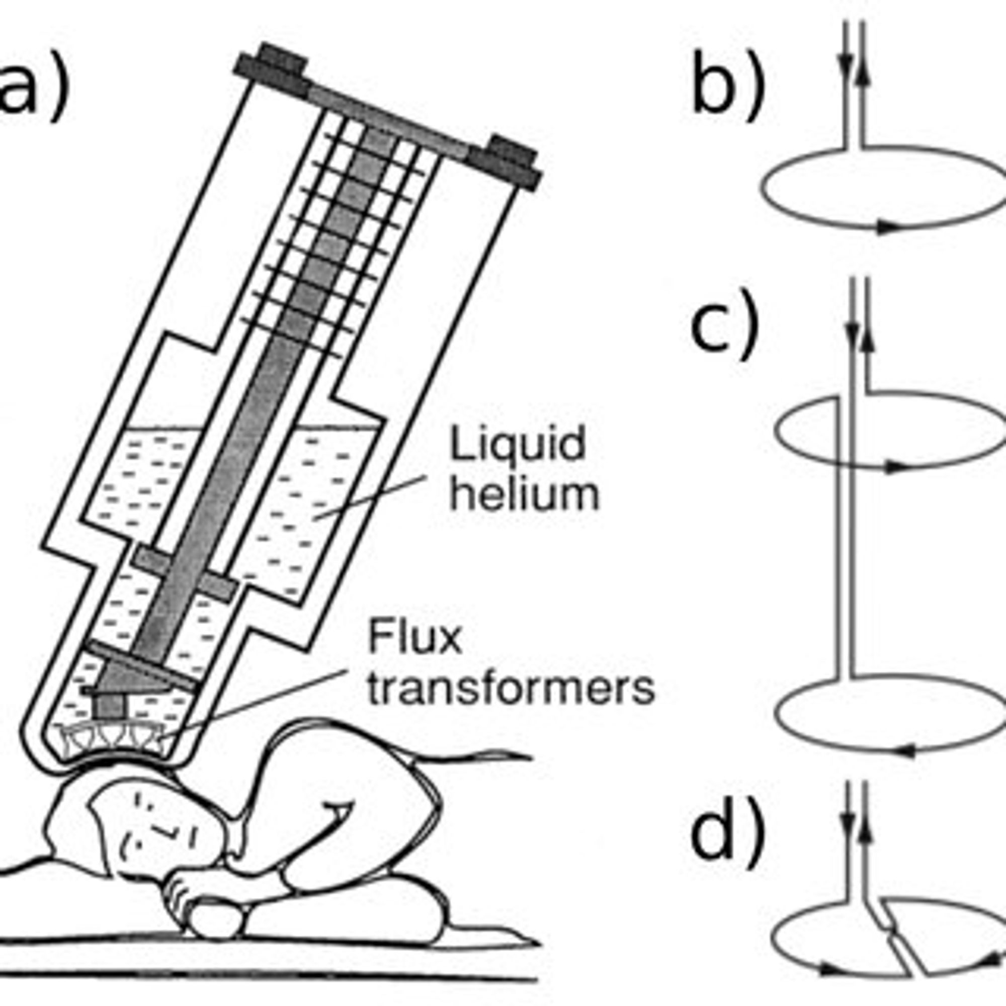 2: Detection of cerebral magnetic fields. a) Schematic representation of the MEG scanner. The bottom of the helium dewar, with the flux-transformer pickup coils near subject's head, is brought as close to the head as possible. Three superconducting flux transformers employed in brain research: b) magnetometer c) axial gradiometer, d) planar gradiometer. Adapted from [Hämäläinen et al., 1993].