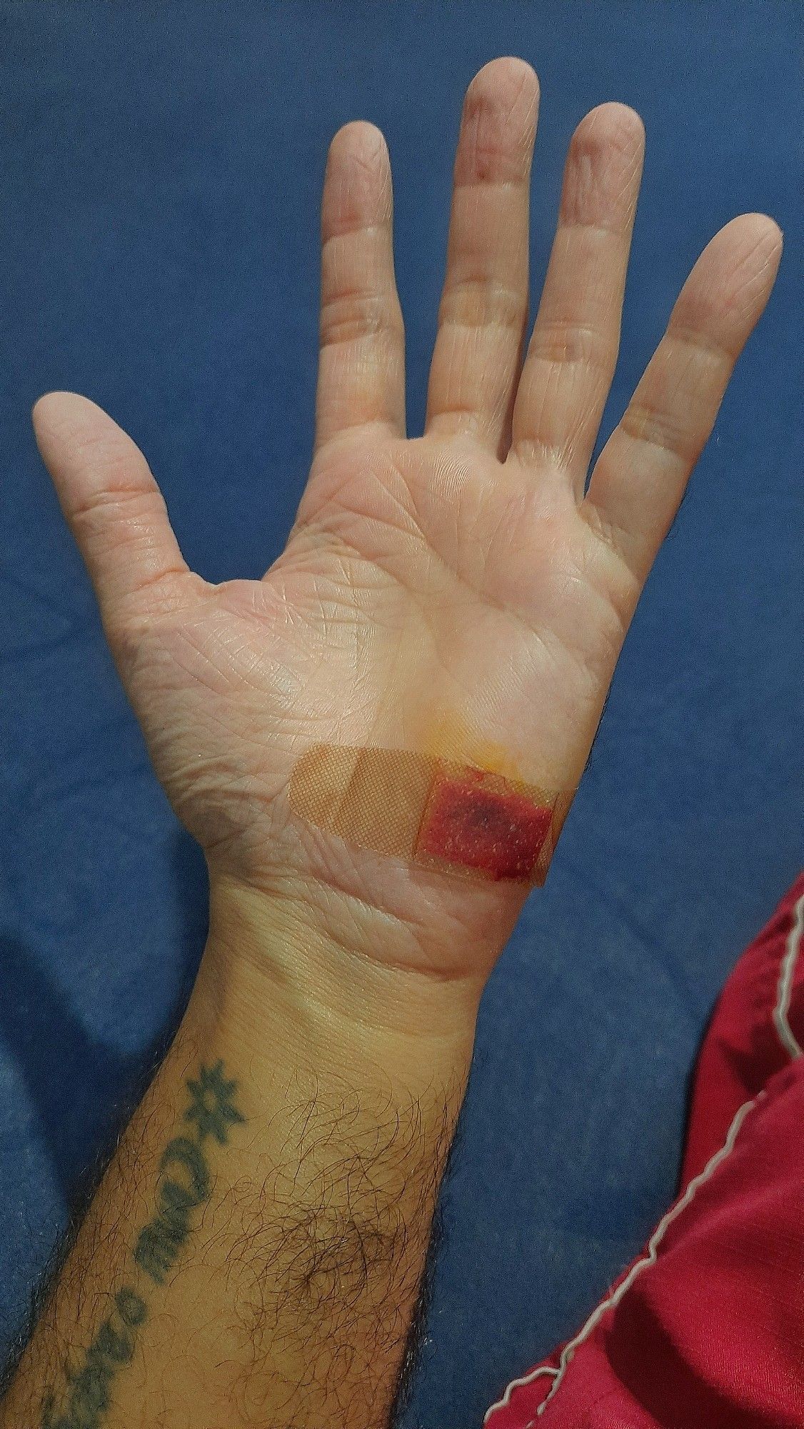 Uma mão esquerda com um corte manchando o curativo de sangue.