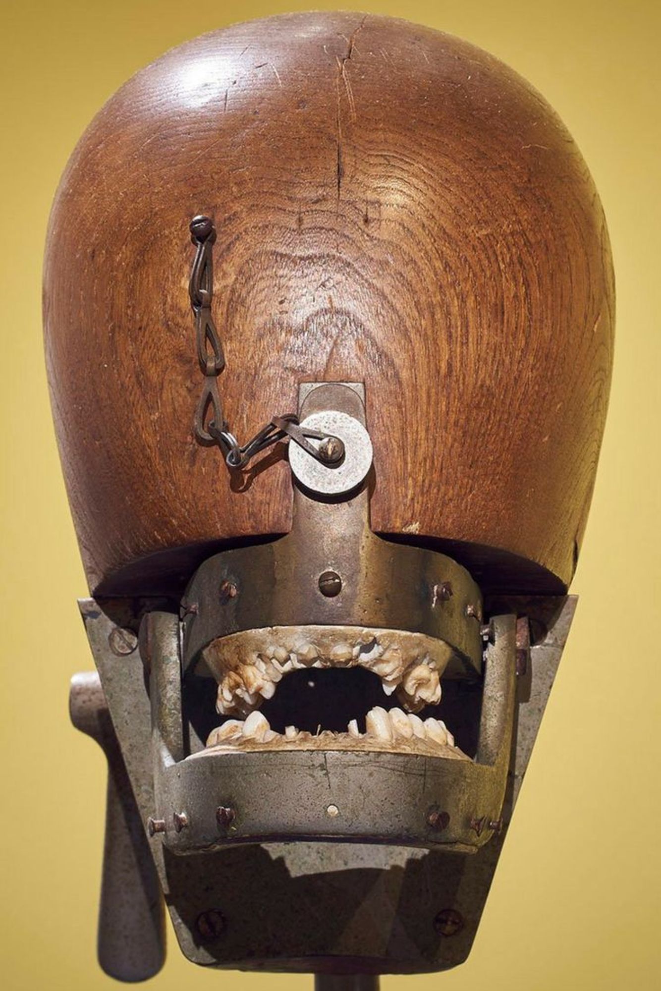 Dental phantom. Teeth inserted into a metal jaw placed into a wooden head (like one used to hold a wig). Held by a metal rod. Teeth in this dental phantom can be seen to be missing and broken.