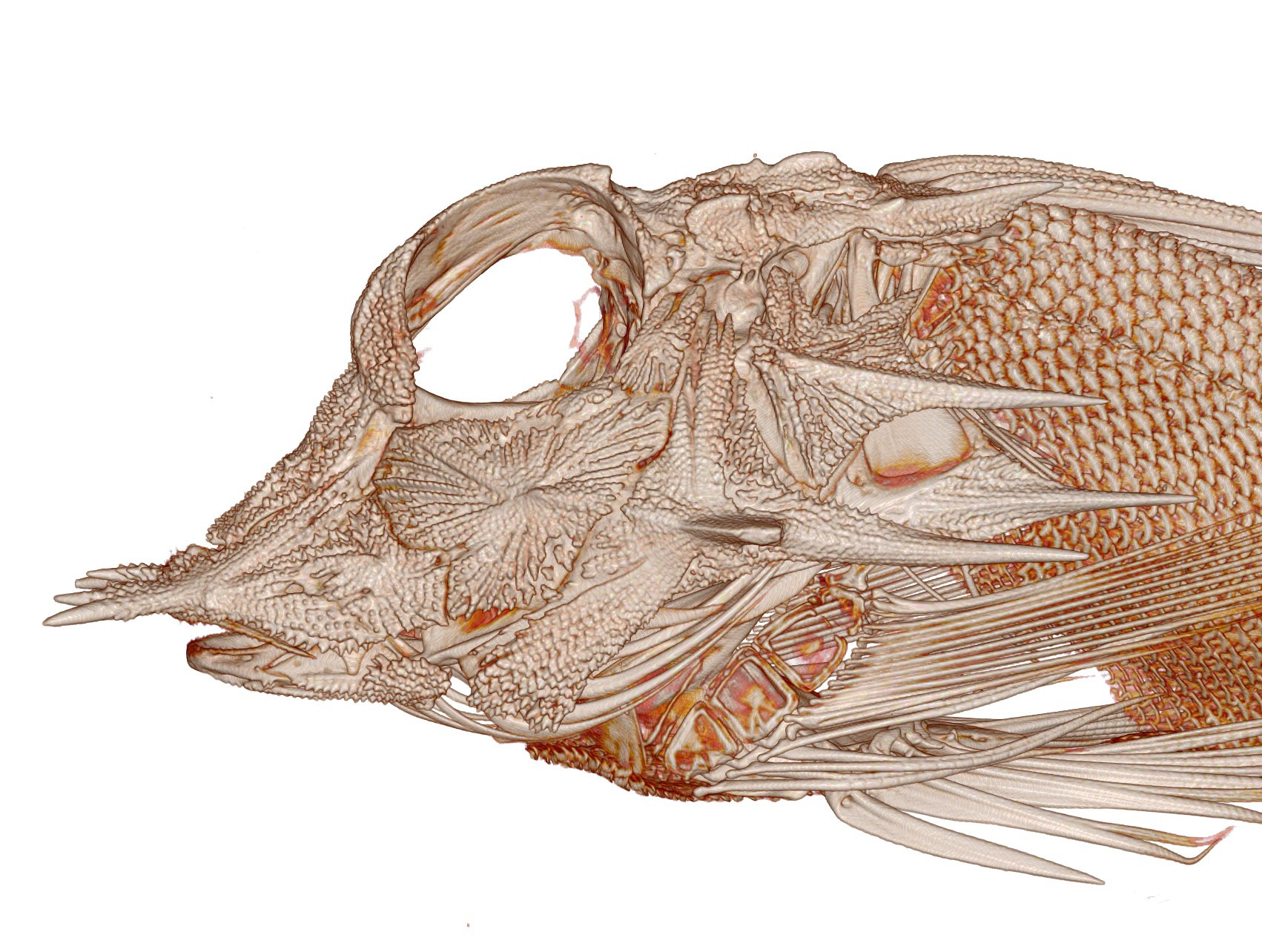 Lateral view of a CT of a searobin