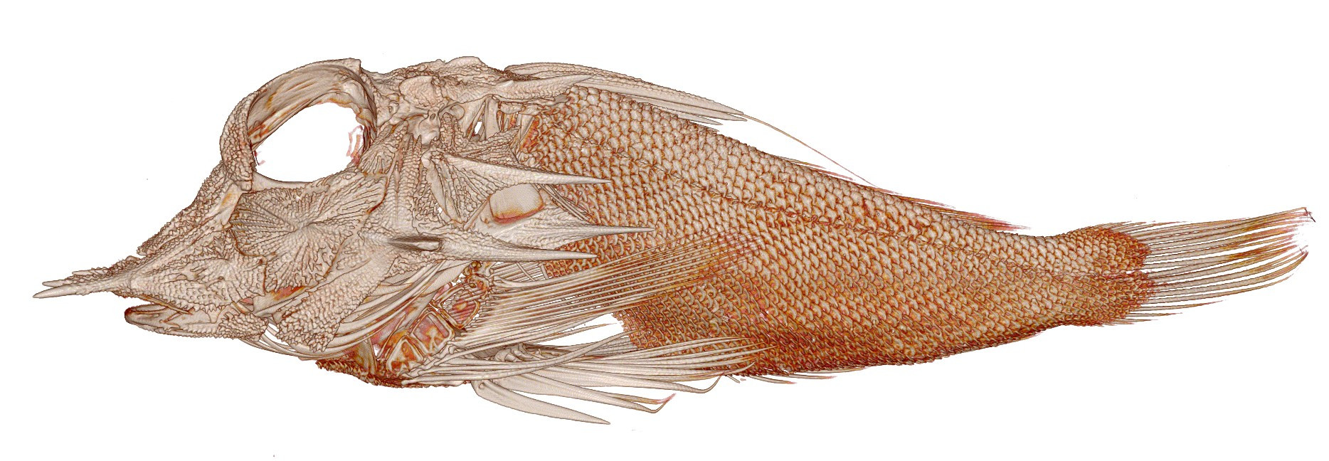 Lateral view of a CT of a searobin