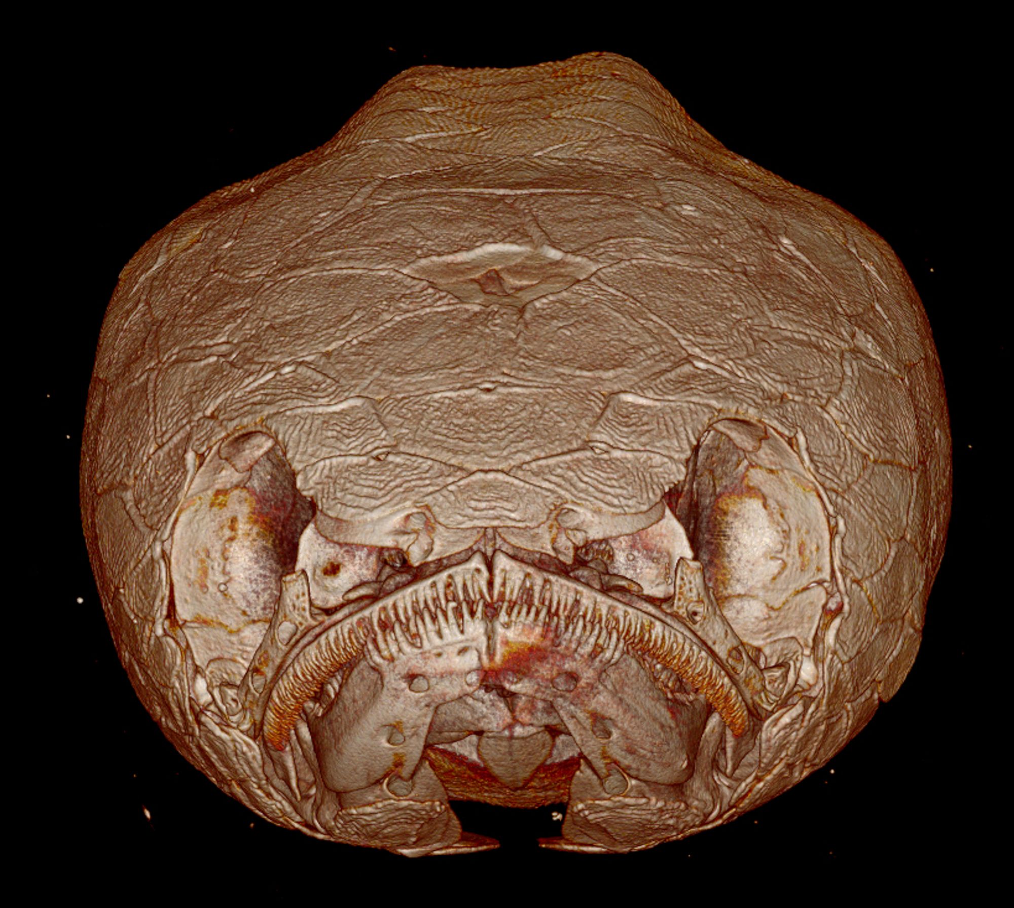 Channa CT anterior view