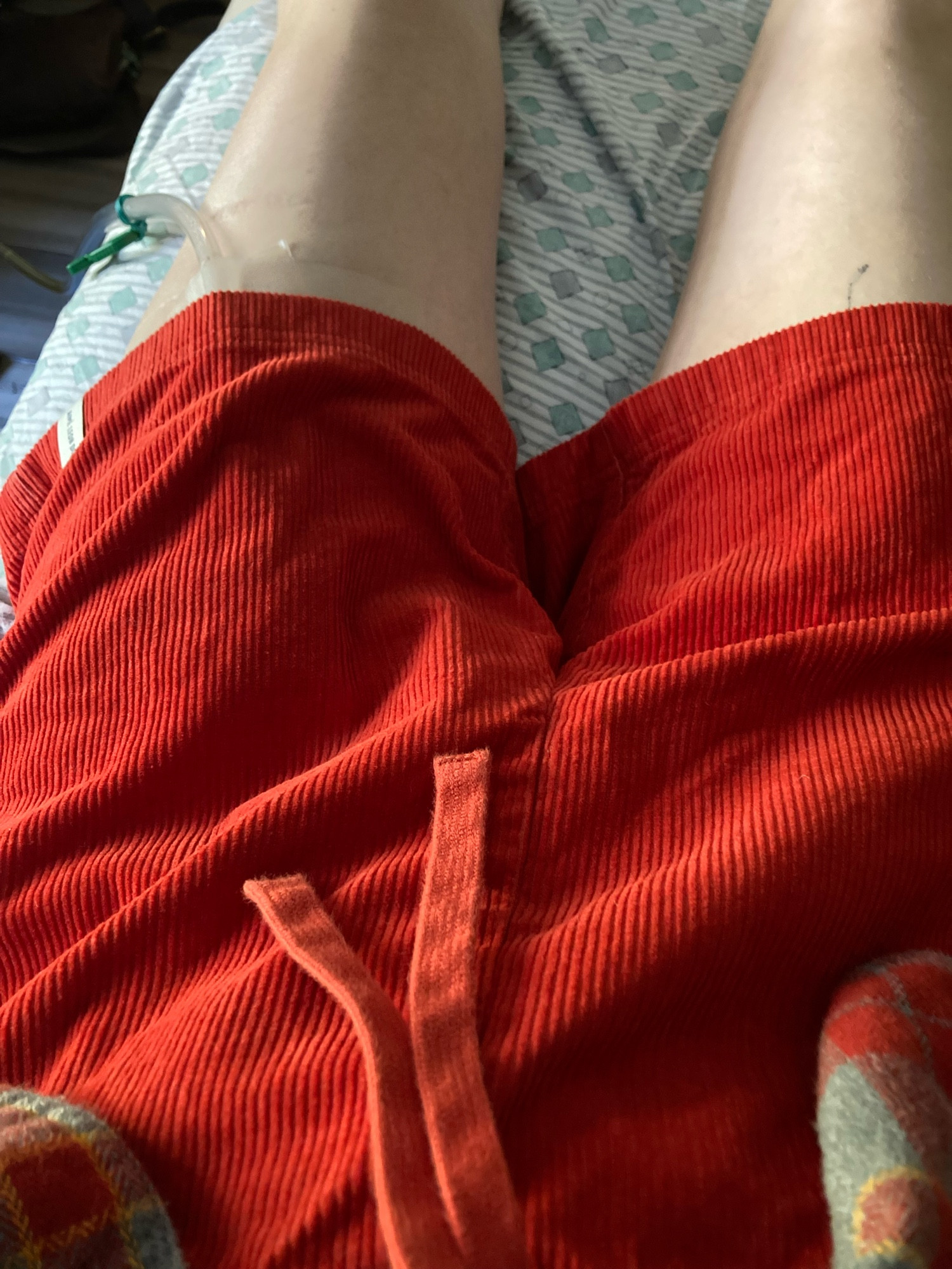 downward shot of orange corduroy shorts with Aime Leon Dore tag on the bottom of the left short. Catheter tube visible from left short.