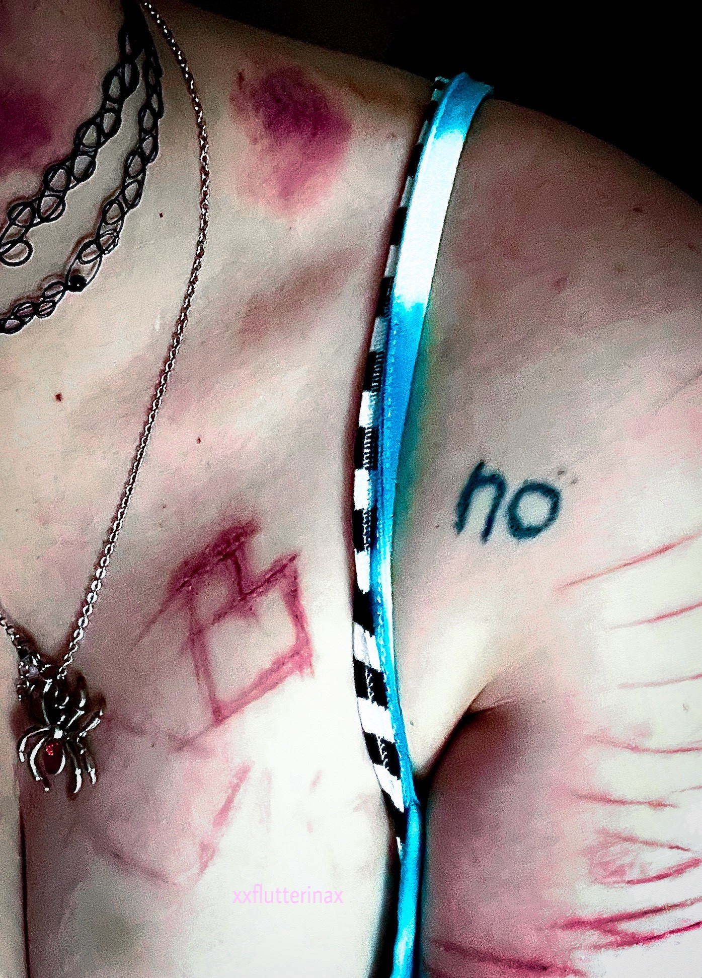 angel’s chest and shoulder. his skin is pale and covered in lacerations. some are shaped like a heart. he has multiple dark hickeys. he has a necklace of a spider hanging on his chest, and a stick and poke tattoo on his shoulder that says ‘no’. his black and white striped bra strap is visible under his green spaghetti strap top.