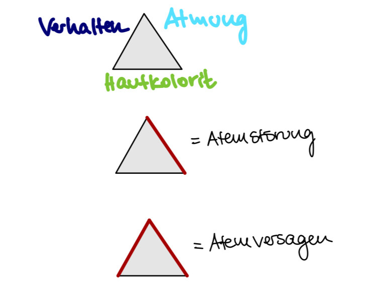 Die pädiatrische Ersteinschätzung nach dem Untersuchungsdreieck „Verhalten, Atmung, Hautkolorit“. Bei Auffälligkeiten bei der Atmung und dem Verhalten befindet sich das Kind höchstwahrscheinlich im Atemversagen.