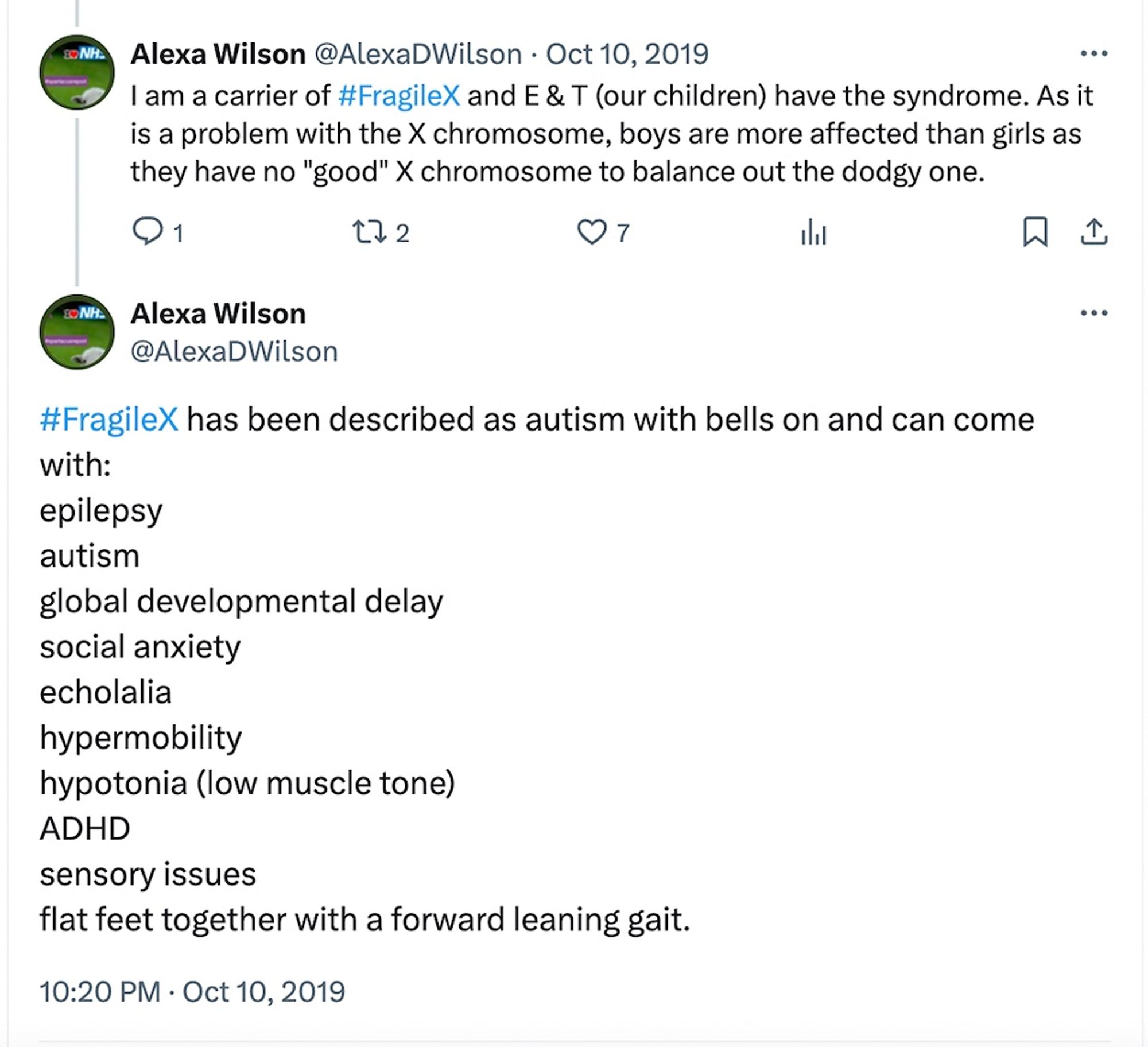 I am a carrier of FX and our kids (E&T) have the syndrome. As it is a problem with the X chromosome, boys are more affected than girls as they have no "good" X chrom. to balance out the dodgy one. 
FX has been described as autism with bells on and can come with: epilepsy, autism, global developmental delay, social anxiety, echolalia, hypotonia, ADHD, sensory issues and flat feet with forward leaning gait.