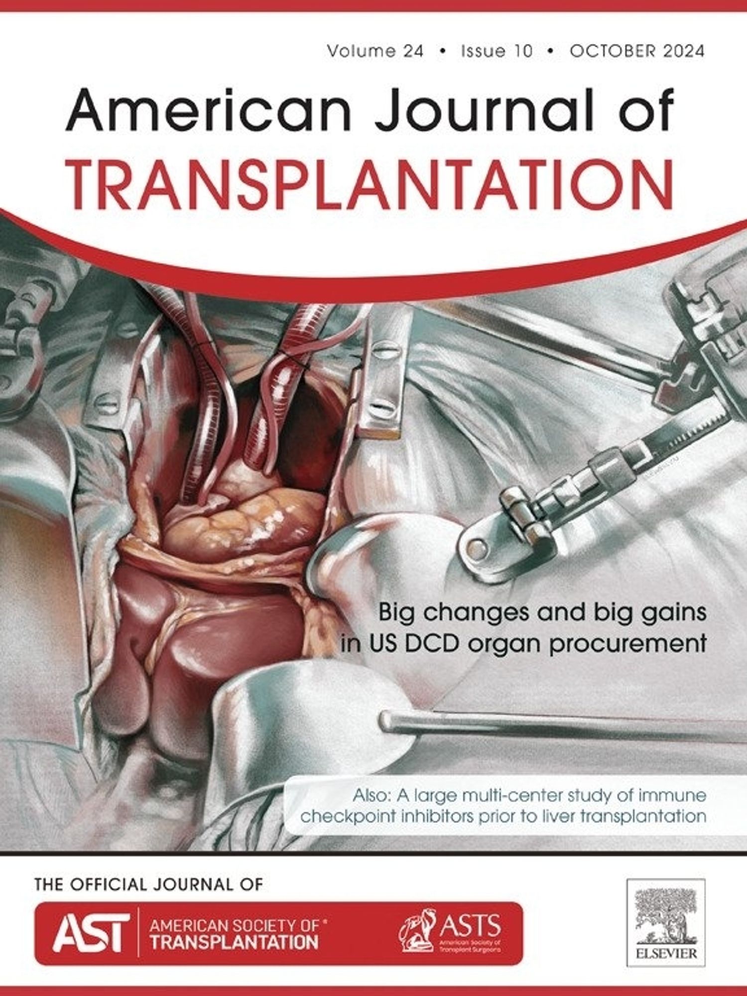 the October 2024 issue cover for The American Journal of Transplantation, an illustration of a surgical scene showing a cannulated heart and liver, framed by large retractors. the headline reads "Big changes and big gains in US DCD organ procurement"