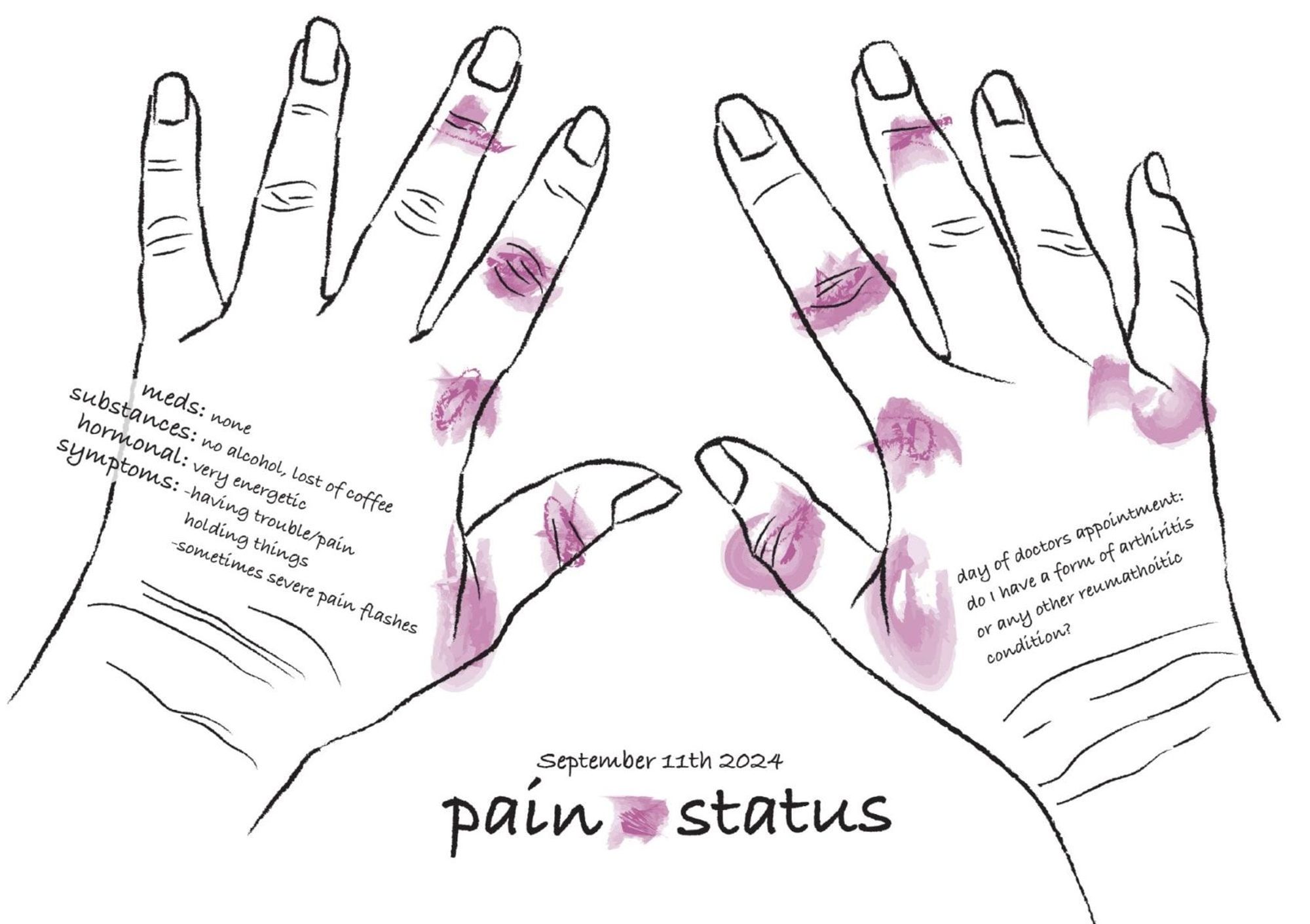 An illustration of two hands covered with colorful scribbles, marking the areas of pain experienced by the author on September 11, 2024. The left hand includes text annotations detailing the medications, hormone levels, and specific symptoms. The right hand features notes from the author's doctor's appointment. Published by Sonja Kuijpers on Bluesky.