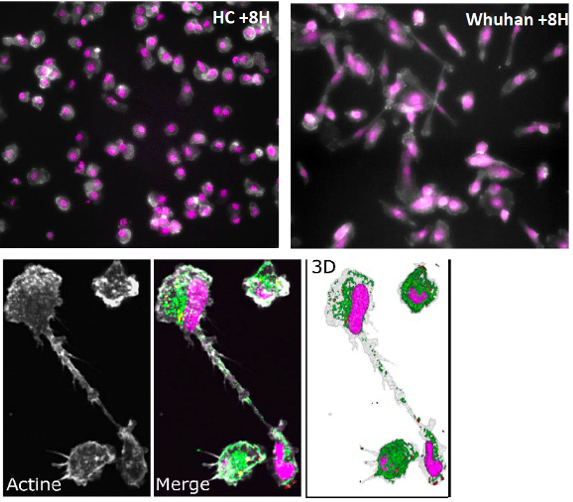 Images au microscope de macrophages, macrophages avec tunnels