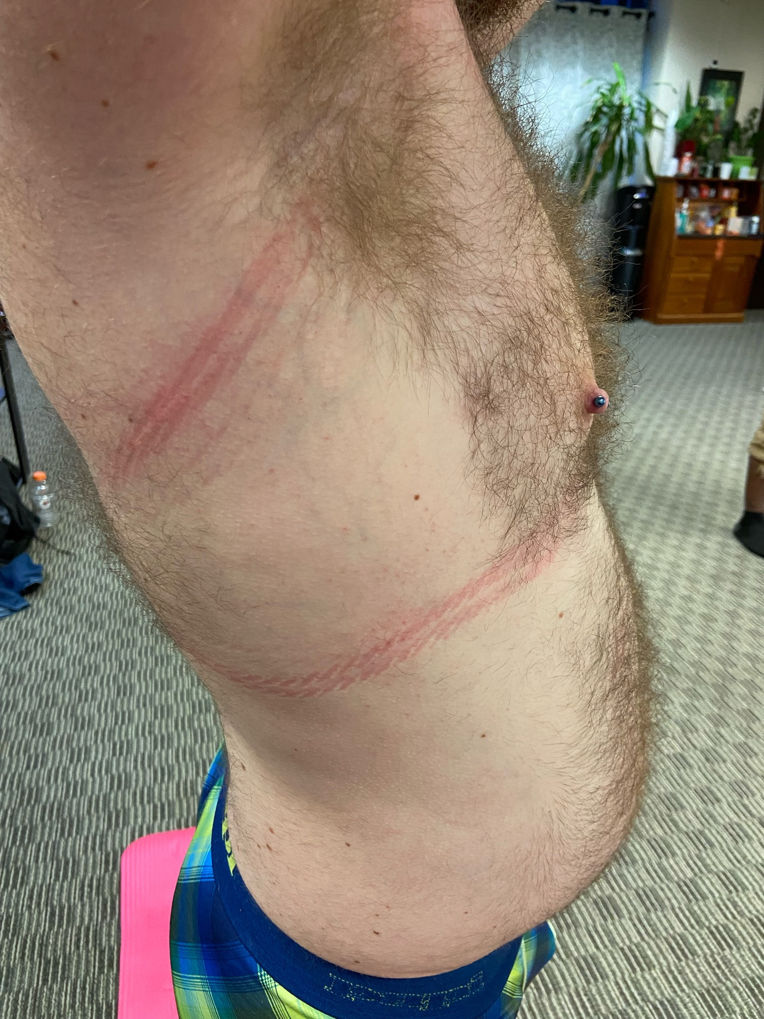 Oh, those lovely rope marks. They show up very fresh on his pale skin but were nearly gone just a bit later.