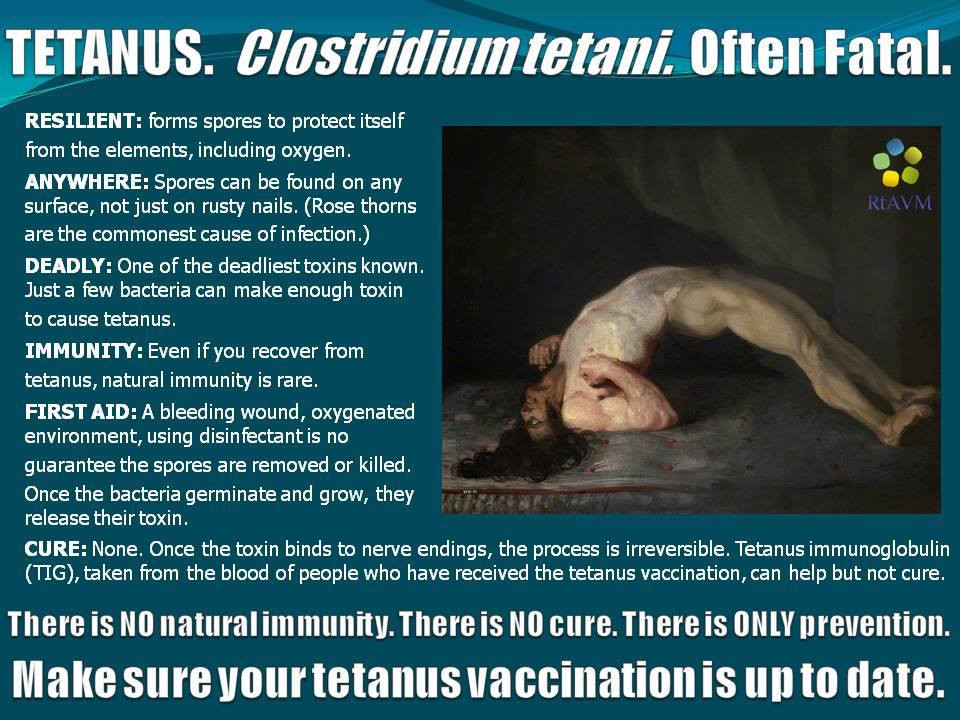 Meme from the FB page 'Refutations to Anti-Vaccine Memes' showing an life-like drawn picture of a person upside down on the ground with back arched and only his heels, shoulders and head on the floor. The text reads: 'TETANUS. 𝘊𝘭𝘰𝘴𝘵𝘳𝘪𝘥𝘪𝘶𝘮 𝘵𝘦𝘵𝘢𝘯𝘪. Often fatal.

RESILIENT: forms spores to protect itself
from the elements, including oxygen.

ANYWHERE: Spores can be found on any
surface, not just on rusty nails, (Rose thorns
are the commonest cause of infection.)

DEADLY: One of the deadliest toxins known.
]ust a few bacteria can make enough toxin to cause tetanus.

IMMUNITY: Even if you recover from
tetanus, natural immunity is rare.

FIRST AID: A bleeding wound, oxygenated
environment, using disinfectant is no
guarantee the spores are removed or killed.
Once the bacteria germinate and grow, they
release their toxin.

CURE: None. Once the toxin binds tonerve endings, the process is irreversible, Tetanus immunoglobulin
(TIG), taken from the blood of people who have received the tetanus vaccination, can help but not cure.

There is NO natural immunity. There is NO cure. There is ONLY prevention.
Make sure your tetanus vaccination is up to date.'