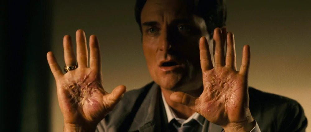 Officer Thomas Gucci in Silent Hill (2006), showing his burned hands.