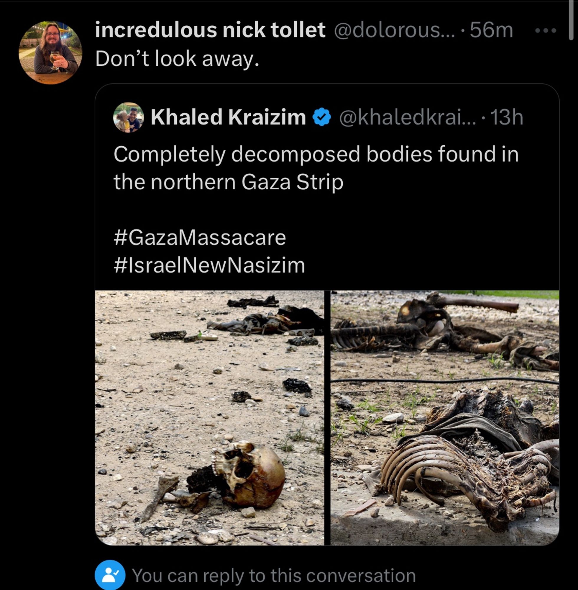 Nick QTing a picture with the comment: Don’t look away. The picture depicts:

Bodies, allegedly (probably) from the Gaza Strip which have been scavenged by animals and of which mostly remain skeletons.