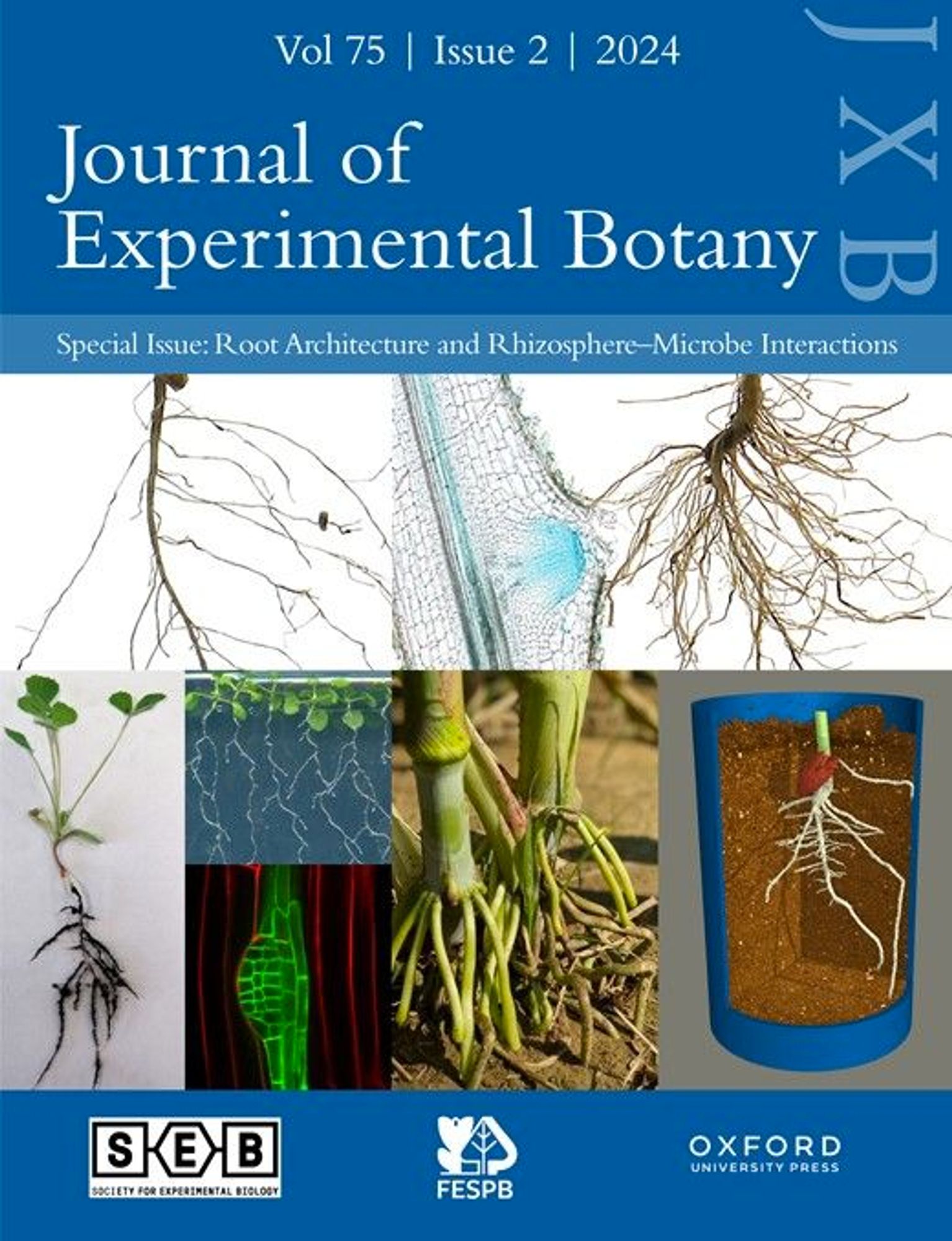 (Top) CaWIP2 contributing to lateral root development in chickpea showed high expression in the lateral root primordia (Debasis Chattopadhyay); (Bottom left) Medicago truncatula plant with rhizosphere soil surrounding the root and Arabidopsis thaliana seedlings with developing lateral roots (Gifford lab); (Bottom middle) Fluorescent image of a developing lateral root in Arabidopsis thaliana (Vissenberg lab) and brace roots in Sorghum (Ashley Hostetler); (Bottom right) Non-destructive visualisation of Phaseolus vulgaris roots using X-ray CT imaging (Craig and Solomon Sturrock).