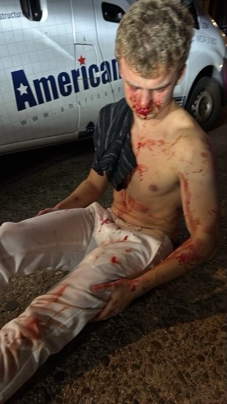 Bloodied doge "big balls" after getting beaten by juviniles.