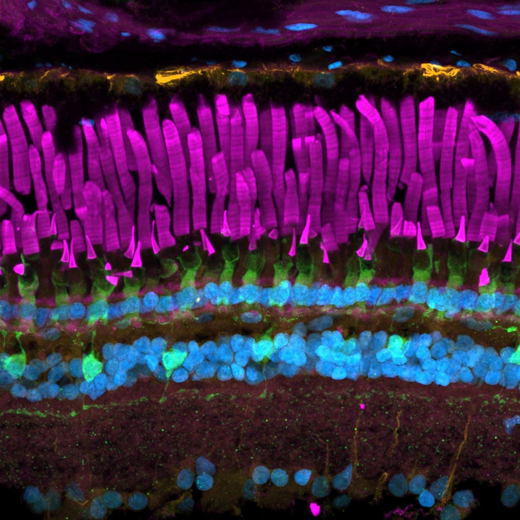 An image of a frog retina that shows the photoreceptor outer segments (purple), the cone inner segments and bipolar cells (green), nuclei (blue), and the retinal pigment epithelium (orange).