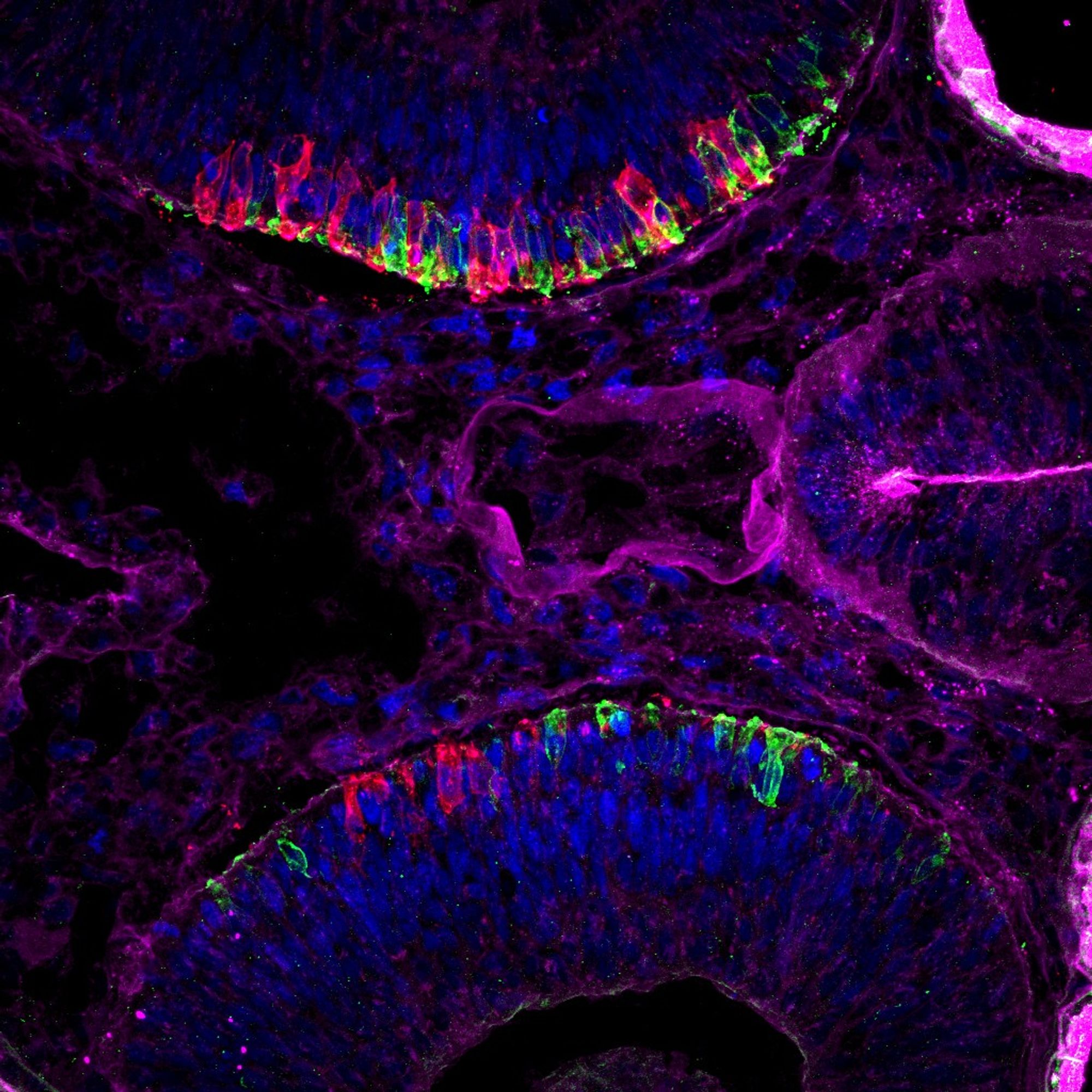 An image of developing frog eyes and brain. The red represents early rods and the green early cones.