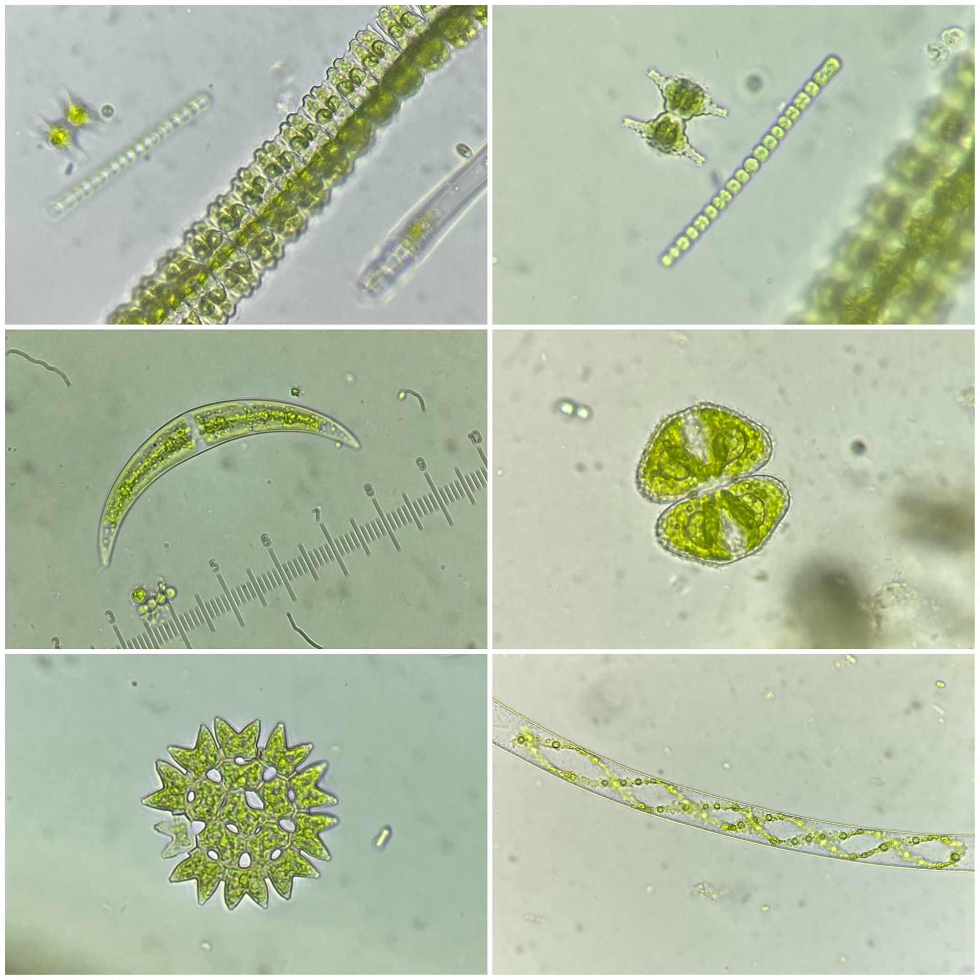 Verschillende soorten sieralgen: 1.) Desmidium swartsii. 2.)staurastum cf. polymorphum?; dat kralensnoer er naast is een blauwalg (Nostoc). 3.) Closterium. 4. Cosmarium. 5. Een radervormige groenalg, Pediastrum duplex. En 6.) Spirogyra met spiraalvormige chloroplast.