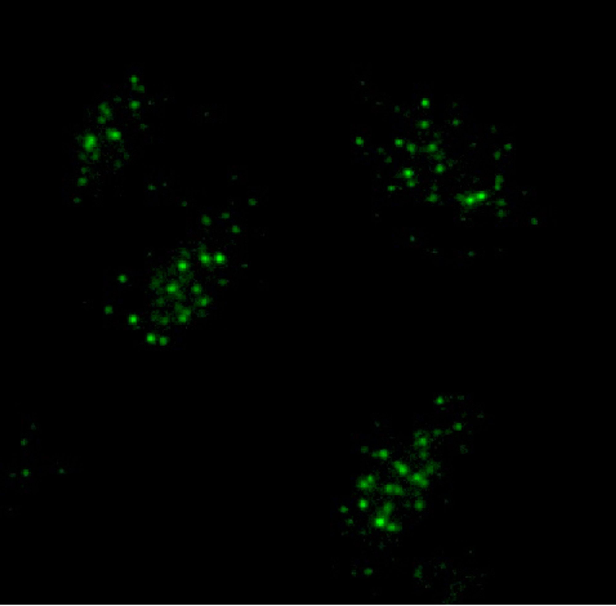 Fluorescent images of cells with green dots where telomeres are located. The background is black.