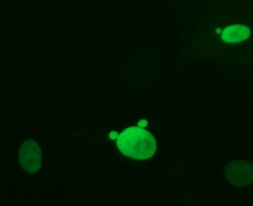 Green fluorescent protein expressed in human cell nuclei. Four nuclei were in the image. One nucleus has two tiny additional micronuclei, another nucleus has one micronucleus.