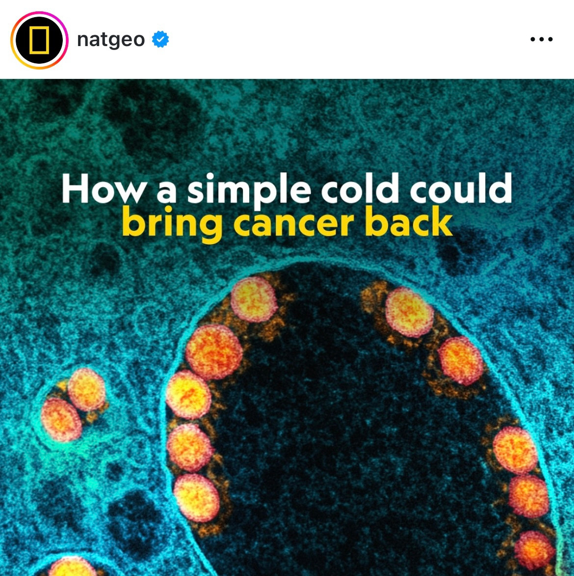 Nat Geo feature article - "how a simple cold could bring cancer back"
