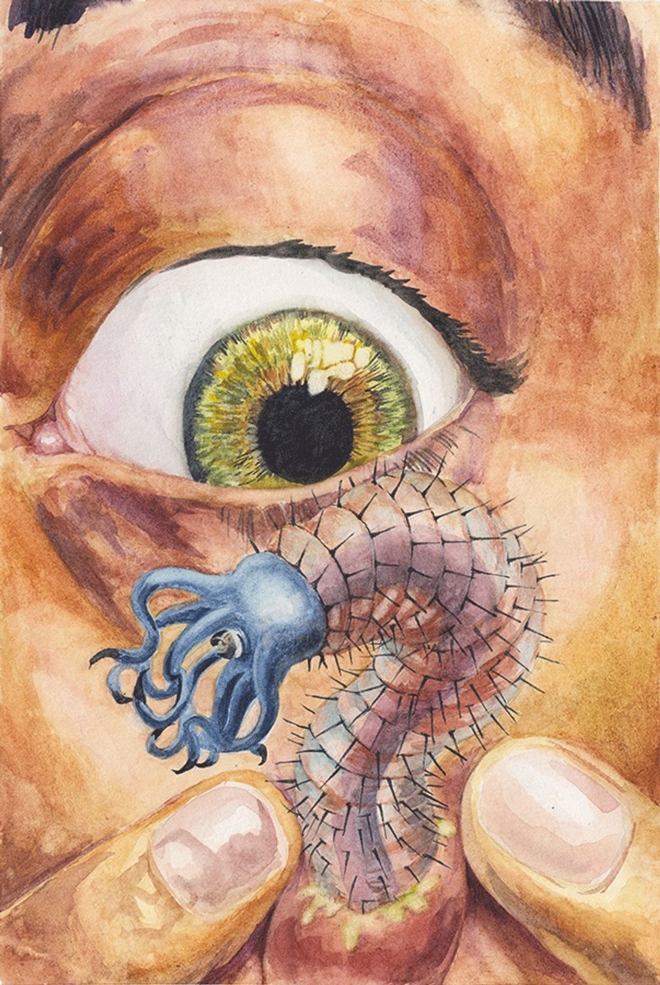 Body horror art. A watercolor painting of close crop of a face showing the cheek and eye area. The eye stares wide-eyed as a worm-like creature (monster?) emerges from a zit that is being popped.