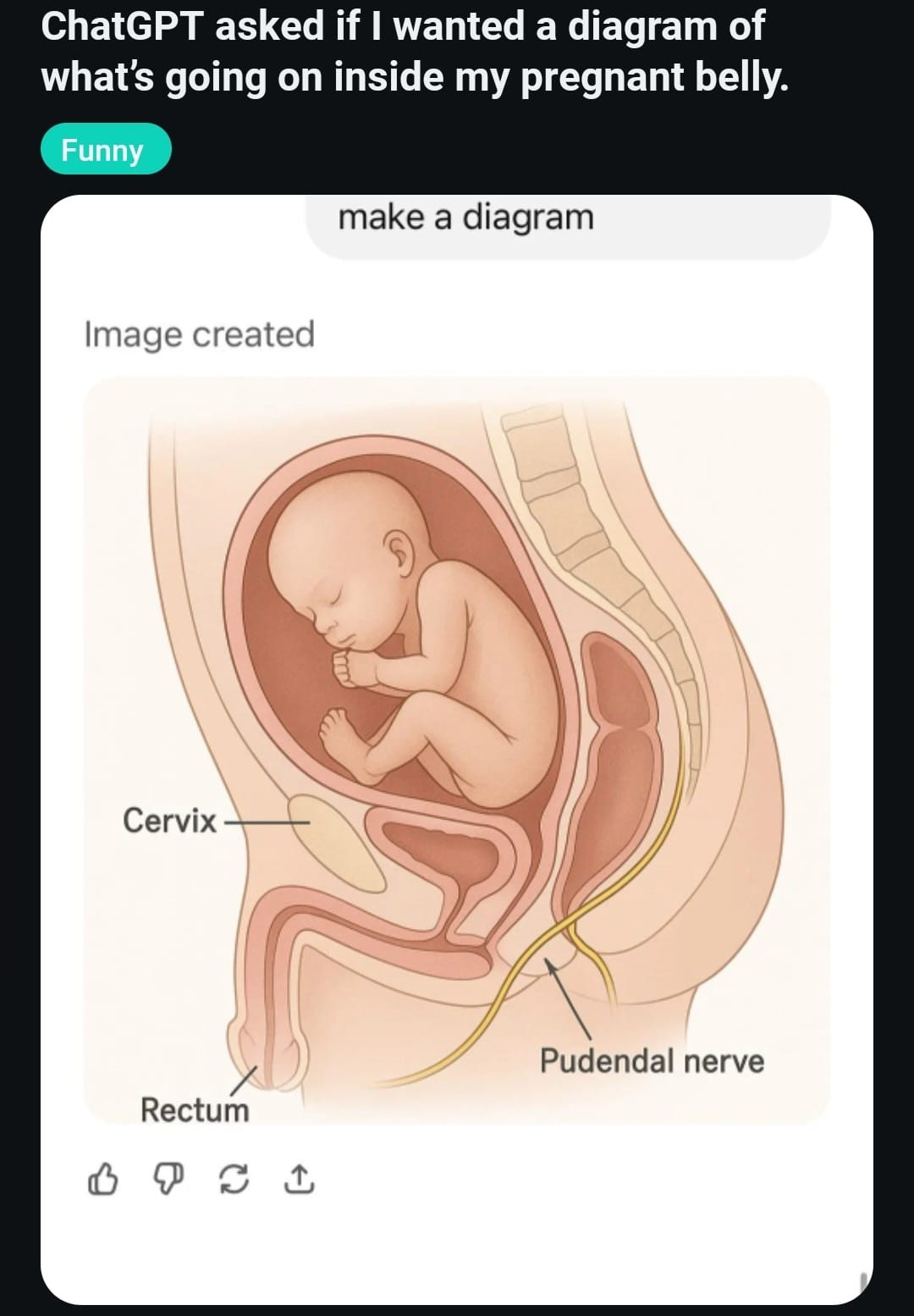 Screenshot of a reddit post: ChatGPT asked if I wanted a diagram of what's going on inside my pregnant belly.

A screenshot of ChatGPT's response. It is a side view of a foetus gestating in the uterus. The foetus is head-up with no umbilical cord or placenta. Behind the uterus is the rectum, which is unlabelled. Trailing down from between the rectum and spine, extending beneath the buttocks to the inner thigh is a yellow line labelled "pudendal nerve. At the front is an oval-shaped part labelled "cervix". And then we really struggle to image describe this bit. The uterus and the bladder are both attached to a single part which is long inside, then extends downwards into a penis with a single exist. This penis is labelled "rectum". 