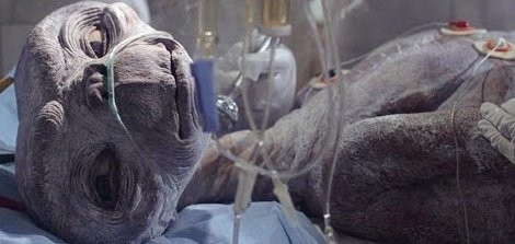 Still from the movie ET showing a dessicated ET hooked up to medical equipment 