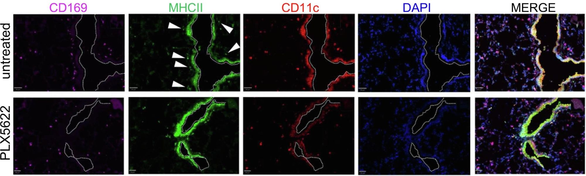 Fluorescence immunohistochemistry/confocal microscopy of lung tissue samples from untreated or PLX5622-treated mice, showing CD169 in magenta, MHCII in green, CD11c in red and DAPI in blue, plus a merged image.