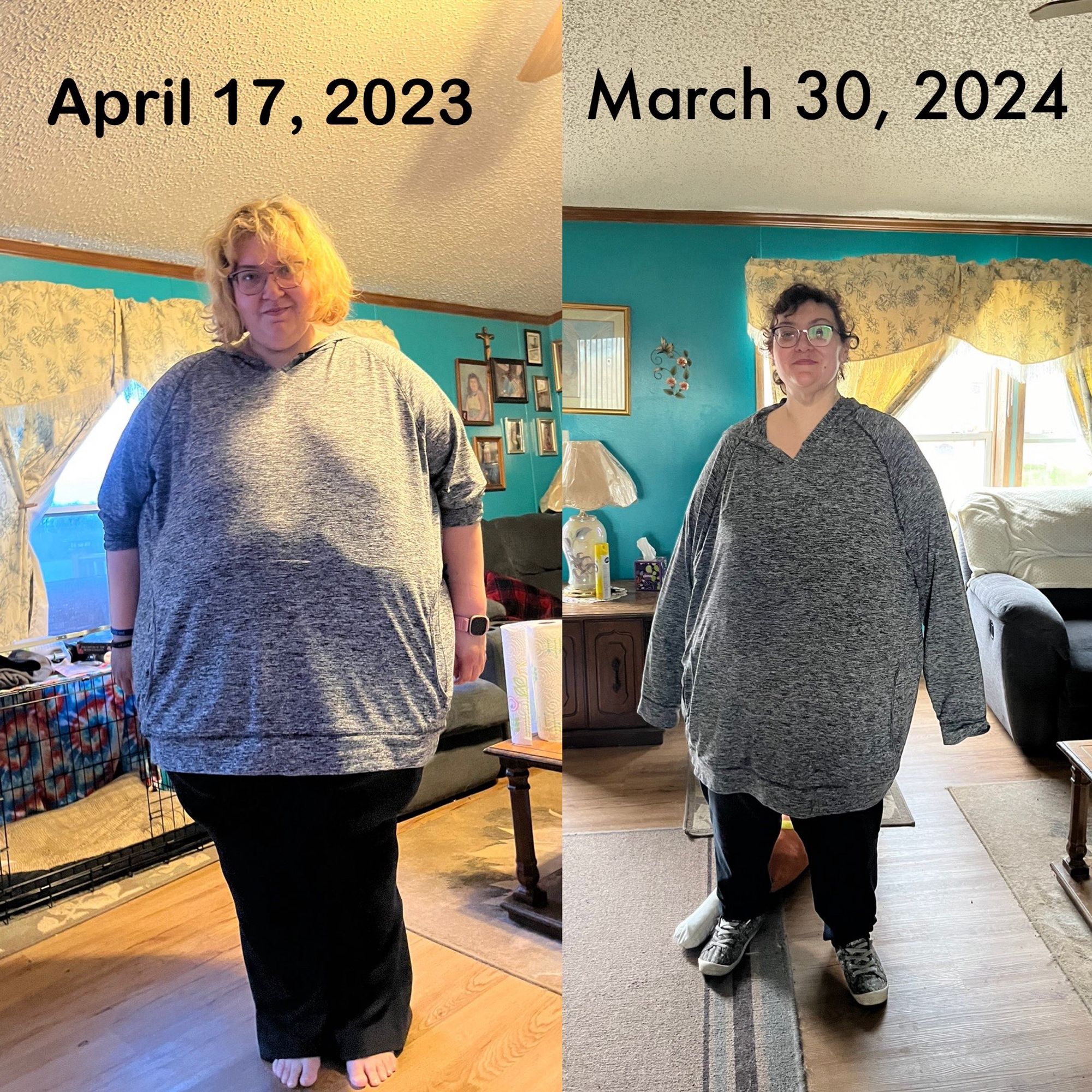 Two pictures of a woman in a grey hoodie and black pants, one is significantly smaller, same woman after bariatric surgery.