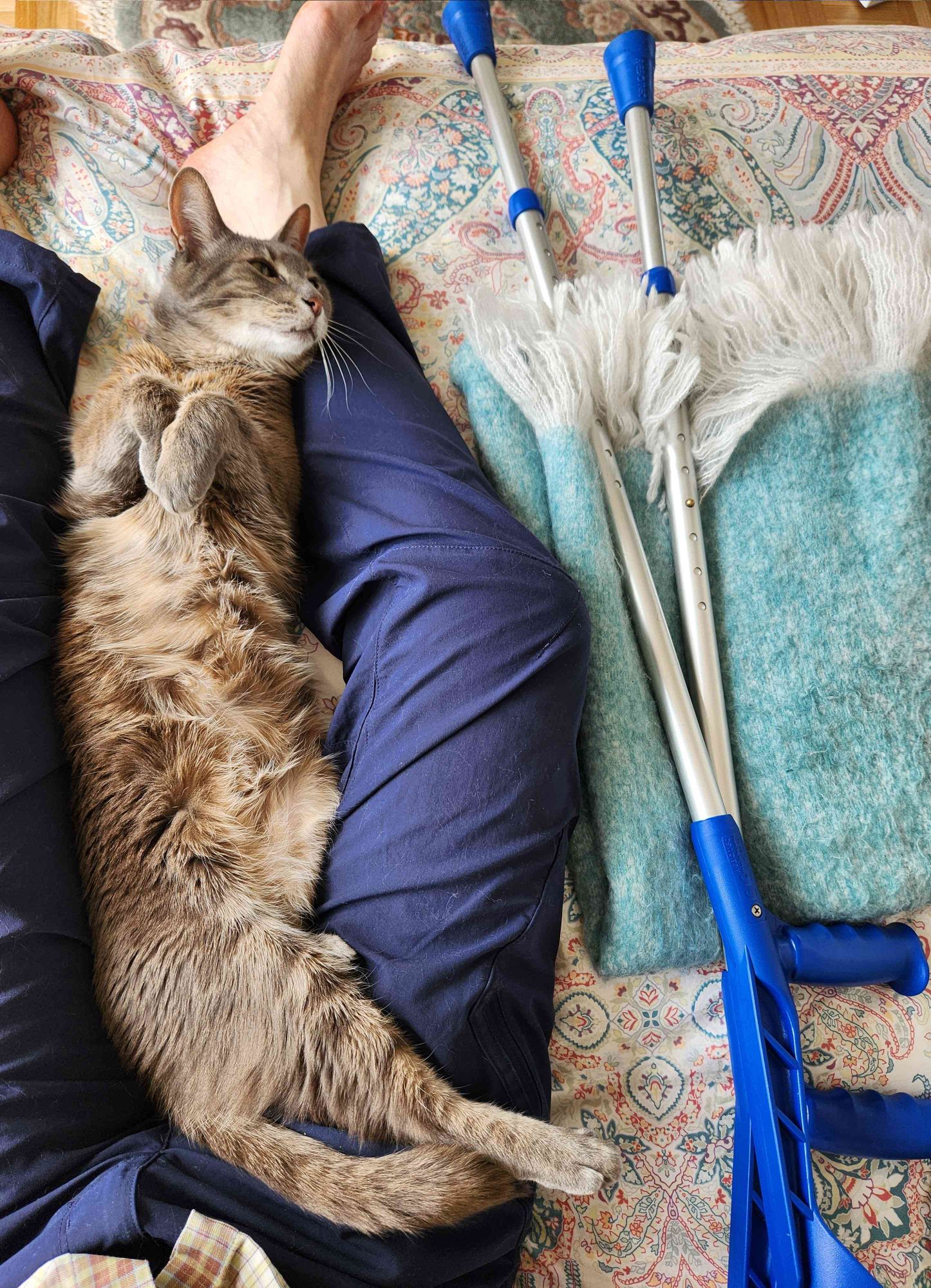 Gray tabby lies on its back lengthways between a pair of dark blue-trousered legs on a bed. His long floppy paws are held above his chest, & his head is inquiringly angled to the right. A pair of blue forearm crutches rests on the right of the pic