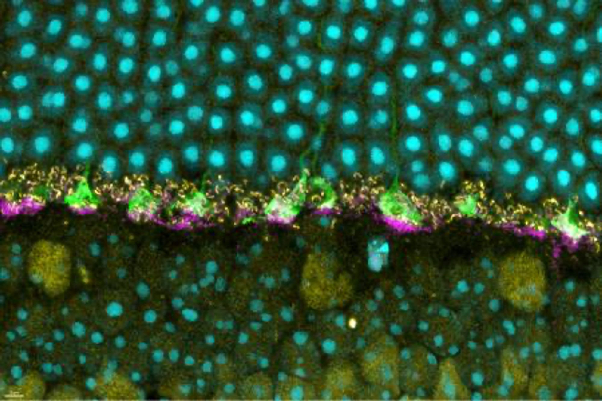 the outer layer of a mouse retina. Normal prion protein (magenta) is visible at the base of photoreceptor terminals, called cone pedicles (green). Specialized synapses are shown in yellow. The nuclei of photoreceptors are in blue above the synapses, and in blue below the synapses are bipolar cells. The cone pedicles relay information about detected light to other retinal nerve cells, which carry the information to the brain where images are constructed. The new study found that prion protein is necessary for the normal operation of the retinal synapses. Credit: NIAID