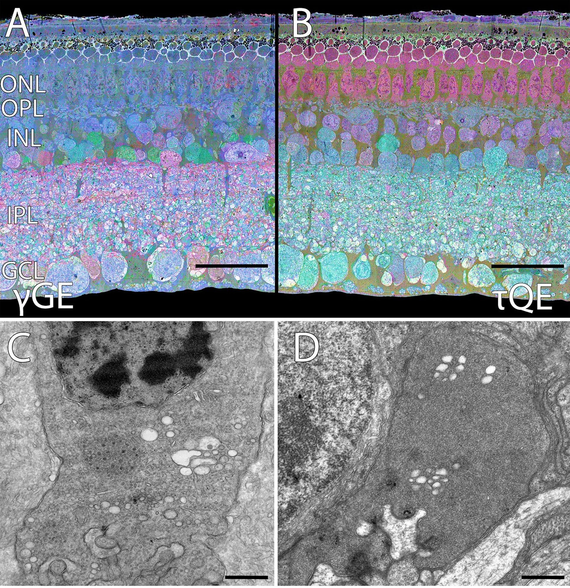 Histological images showing correlative ultrastructure with spatial metabolomics of a hibernating ground squirrel retina.