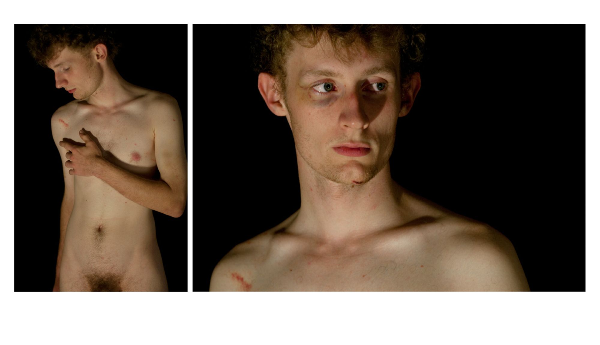 From Object (Hey Dr. Zimbardo!), a series dealing with the topics of dehumanization and objectification. A diptych featuring a nude young man in both panels. He is bruised and cut, the wounds in the process of healing - he had, prior to the shoot, been paid to get filmed being beaten up by a female boxer. In the first panel he holds one hand over his chest. The next is a closer bust crop, and he looks off to the side of the frame, the bruise under his eye clearly visible.