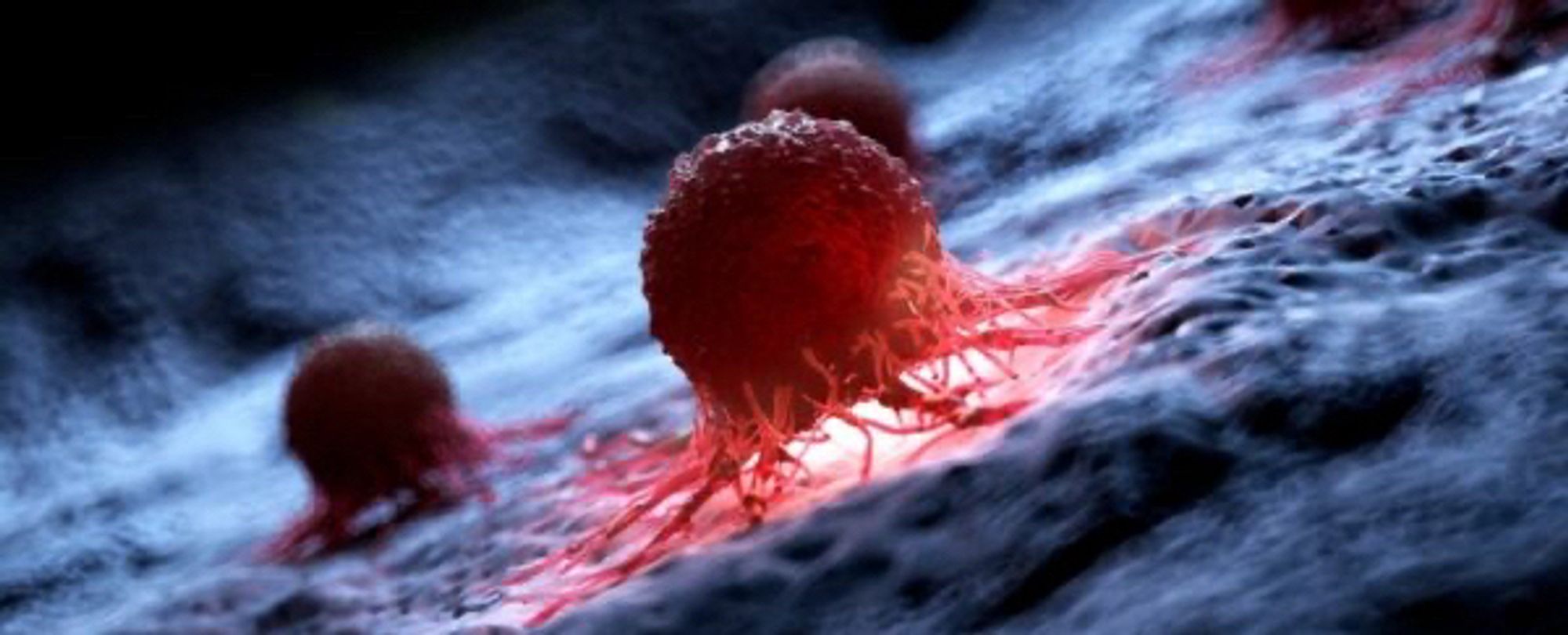 Illustration of a cancer cell. (Science Photo Library/Canva Pro)