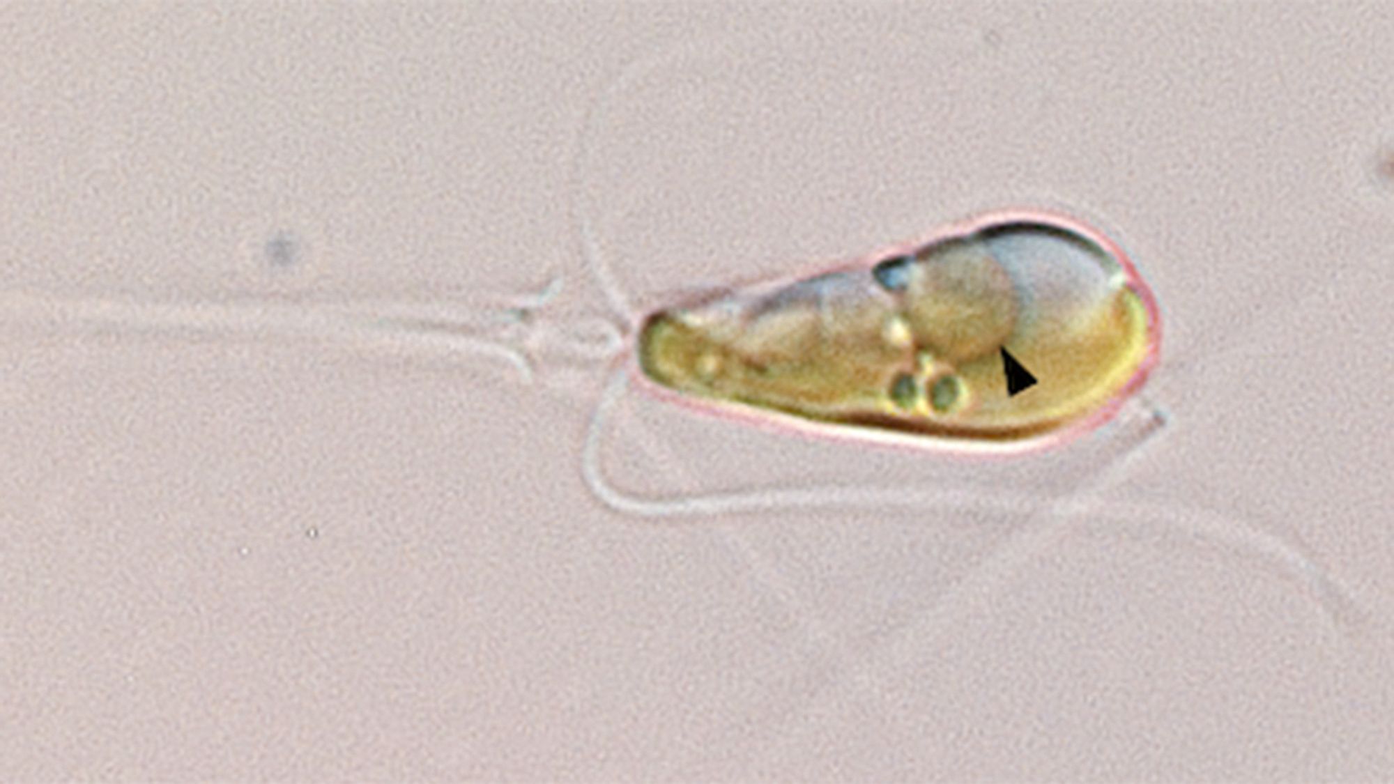 A light microscopy image shows the marine algae Braarudosphaera bigelowii, which is a potentially large evolutionary step. This algae absorbed a bacterium called UCYN-A and formed a new organelle called a nitroplast. The black arrow is pointing to the nitroplast.