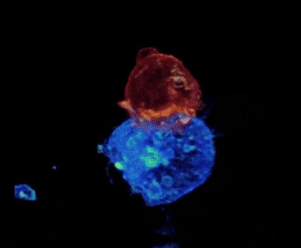 Killer T-cell (red) attacking a lymphoma cancer cell (blue).