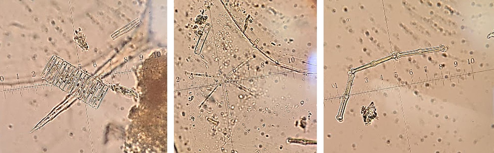 Microscope photographs of algal structures, mostly clear diatom frustules.