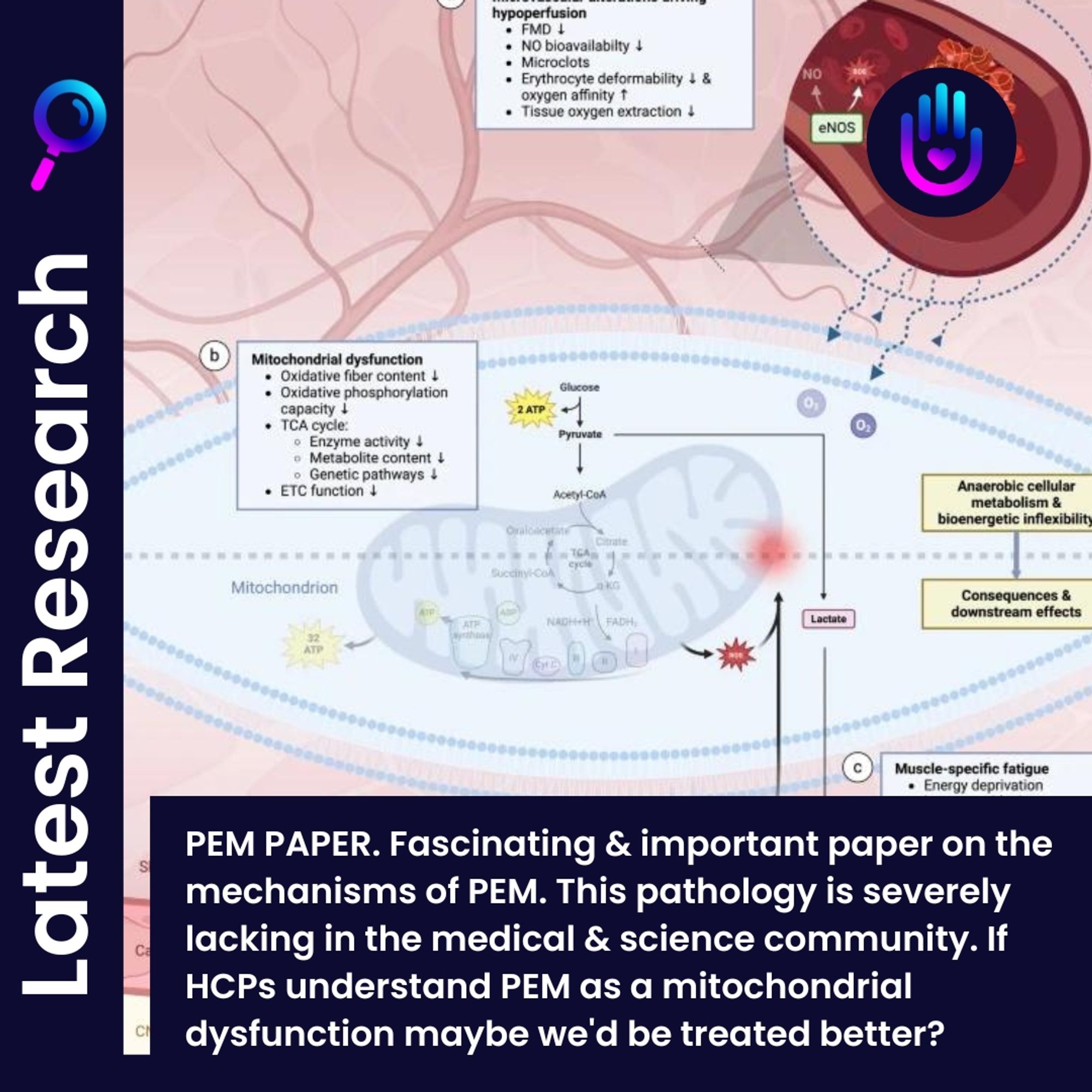 PEM PAPER. Fascinating & important paper on the mechanisms of PEM. This pathology is severely lacking in the medical & science community. If HCPs understand PEM as a mitochondrial dysfunction maybe we'd be treated better?