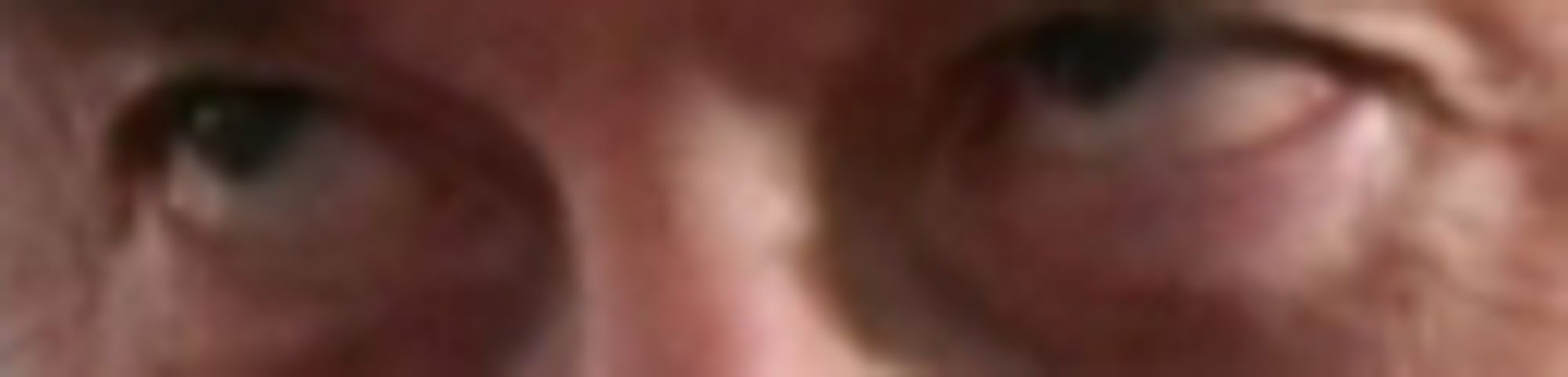 a very zoomed in picture of elon's eyes from the original post. his eyes are glassy and dry looking, the skin around his eyes is saggy and pink, his eyelids droop heavily with the flesh of old age and arguably evil