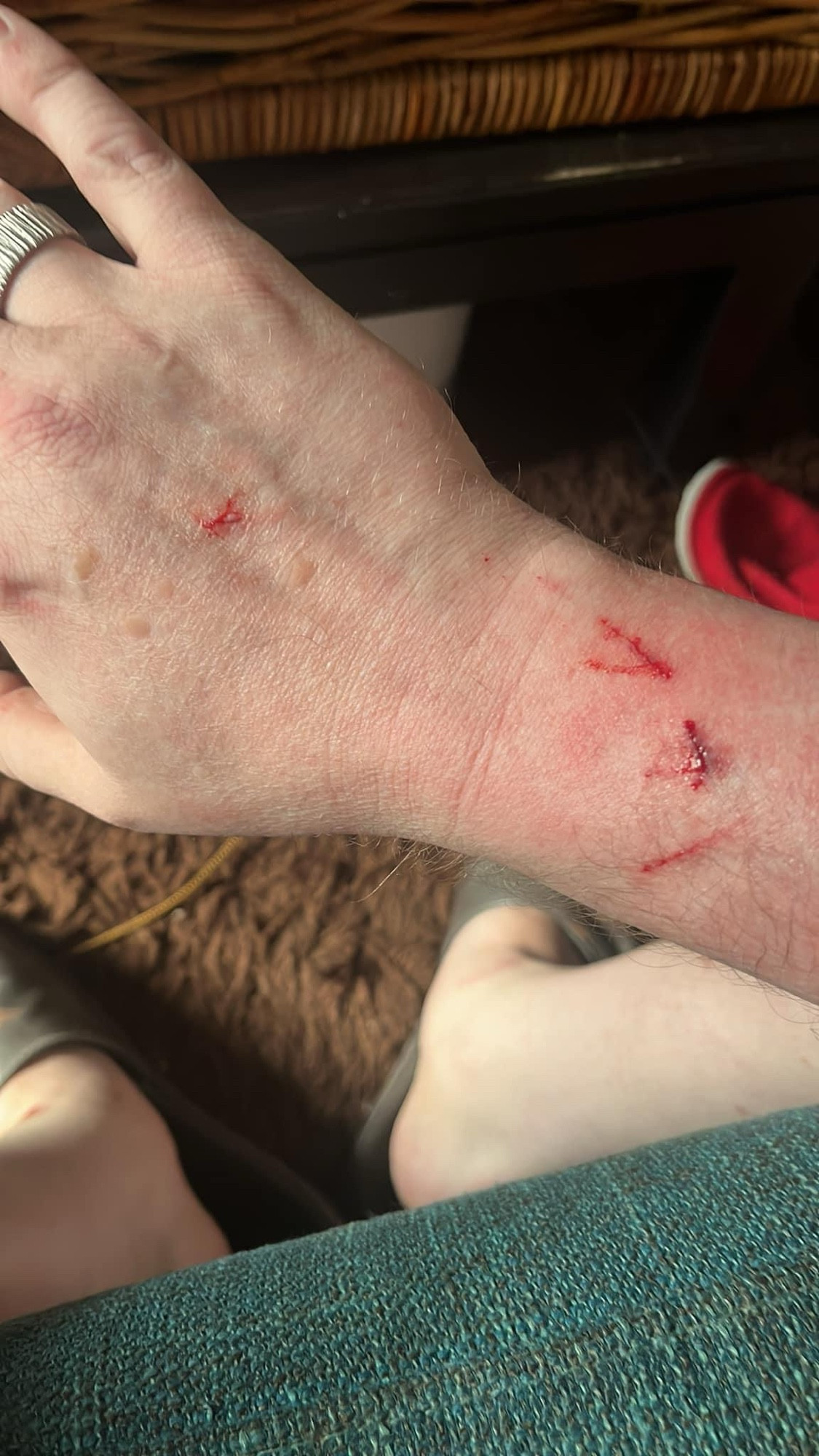 More flesh carnage: a clawed up right hand. 