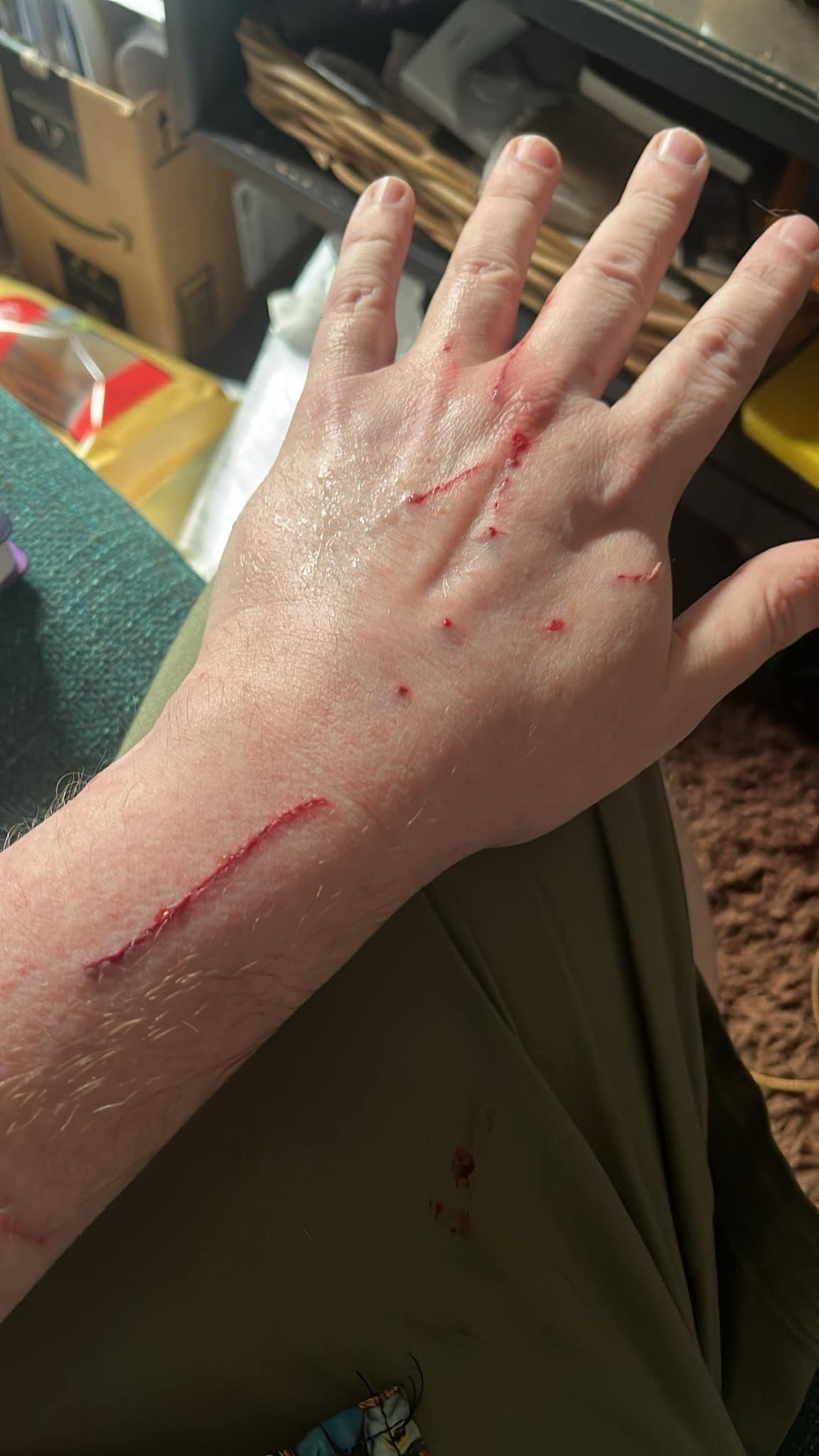 Left hand and arm with deep cat scratches, bleeding. 