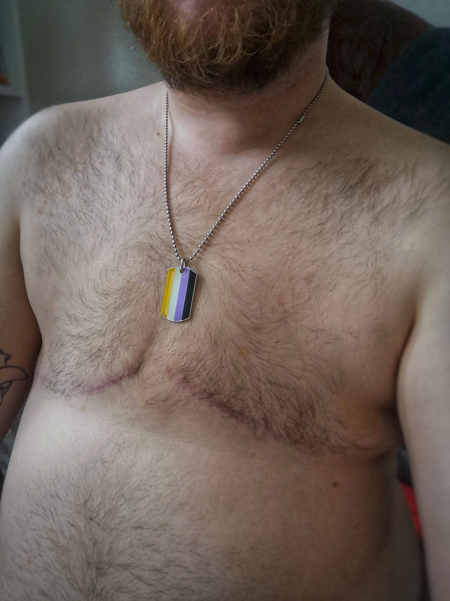 Pup Butch showing their bare chest and fuzzy belly. Surgical scars from top surgery and chest hair, wearing a non-binary pride flag pendant